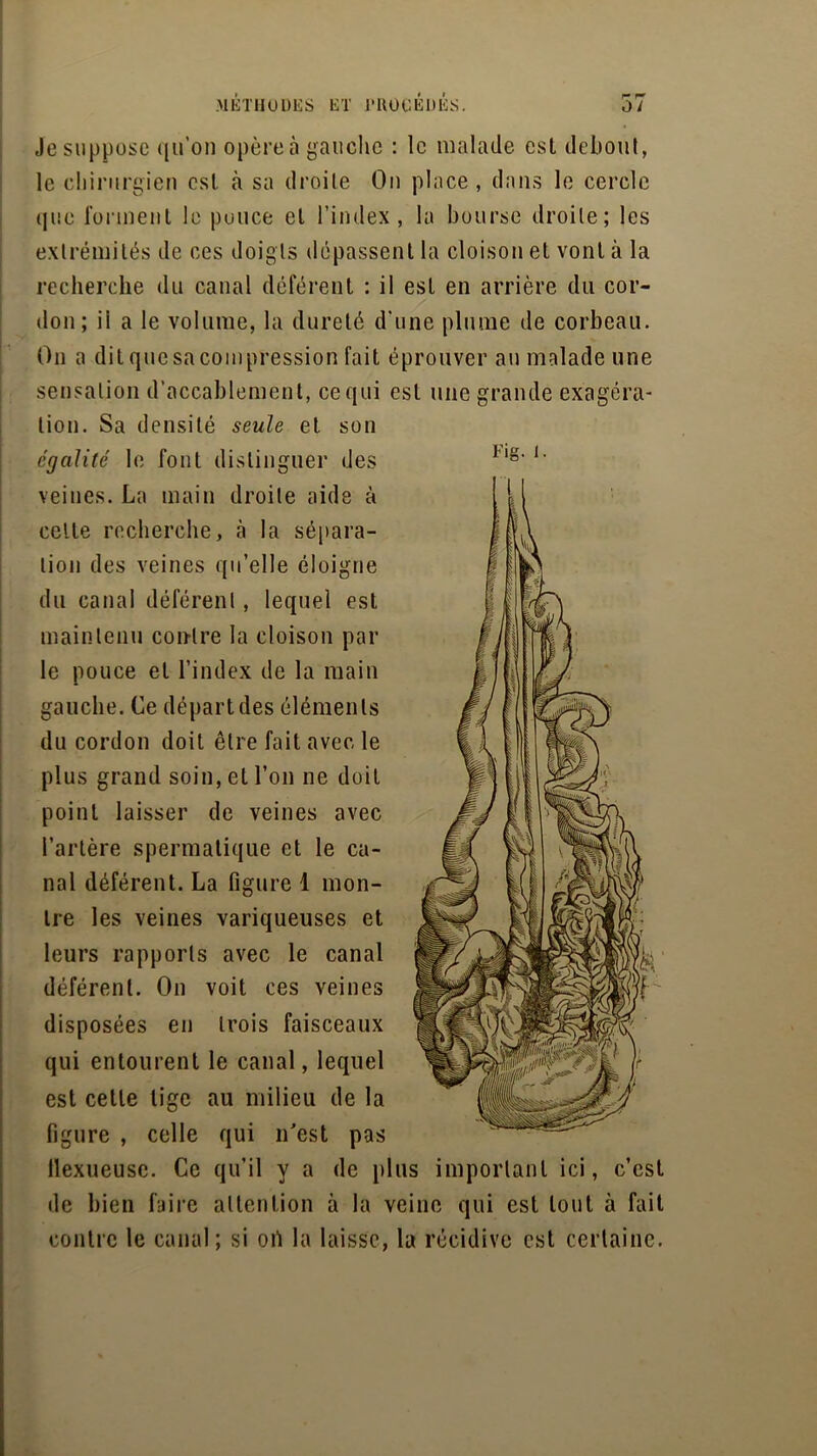 I- P Je suppose quon opère à gauche : le malade est debout, le chirurgien est à sa droite On place , dans le cercle que forment le pouce et l’index, la bourse droite; les extrémités de ces doigts dépassent la cloison et vont à la recherche du canal déférent : il est en arrière du cor- don ; ii a le volume, la dureté d'une plume de corbeau. On a ditquesacompression fait éprouver au malade une sensation d’accablement, ce qui est une grande exagéra- tion. Sa densité seule et son égalité le font distinguer des veines. La main droite aide à celle recherche, à la sépara- tion des veines qu’elle éloigne du canal déférent, lequel est maintenu contre la cloison par le pouce et l’index de la main gauche. Ce départ des éléments du cordon doit être fait avec le plus grand soin, et l’on ne doit point laisser de veines avec l’artère spermatique et le ca- nal déférent. La figure 1 mon- tre les veines variqueuses et leurs rapports avec le canal déférent. On voit ces veines disposées en trois faisceaux qui entourent le canal, lequel est celle tige au milieu de la figure , celle qui n'est pas llexueuse. Ce qu’il y a de plus important ici, c’cst île bien faire attention à la veine qui est tout à fait contre le canal; si oiï la laisse, la récidive est certaine.