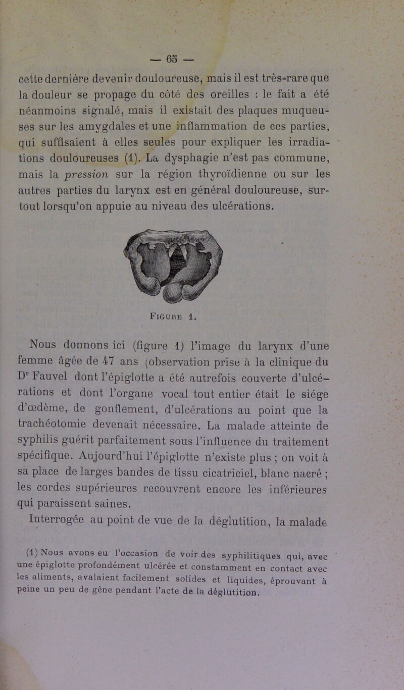 cette dernière devenir douloureuse, mais il est très-rare que la douleur se propage du côté des oreilles : le fait a été néanmoins signalé, mais il existait des plaques muqueu- ses sur les amygdales et une inflammation de ces parties, qui suffisaient à elles seules pour expliquer les irradia- tions douloureuses (1). La dysphagie n’est pas commune, mais la pression sur la région thyroïdienne ou sur les autres parties du larynx est en général douloureuse, sur- tout lorsqu’on appuie au niveau des ulcérations. Figure 1. Nous donnons ici (figure 1) l’image du larynx d’une femme âgée de 47 ans (observation prise à la clinique du Dr Fauvel dont l’épiglotte a été autrefois couverte d’ulcé- rations et dont l’organe vocal tout entier était le siège d’œdème, de gonflement, d’ulcérations au point que la trachéotomie devenait nécessaire. La malade atteinte de syphilis guérit parfaitement sous l’influence du traitement spécifique. Aujourd’hui l’épiglotte n’existe plus ; on voit à sa place de larges bandes de tissu cicatriciel, blanc nacré ; les cordes supérieures recouvrent encore les inférieures qui paraissent saines. Interrogée au point de vue de la déglutition, la malade (1) Nous avons eu l’occasion de voir des syphilitiques qui, avec une épiglotte profondément ulcérée et constamment en contact avec les aliments, avalaient facilement solides et liquides, éprouvant à peine un peu de gène pendant l’acte de la déglutition.