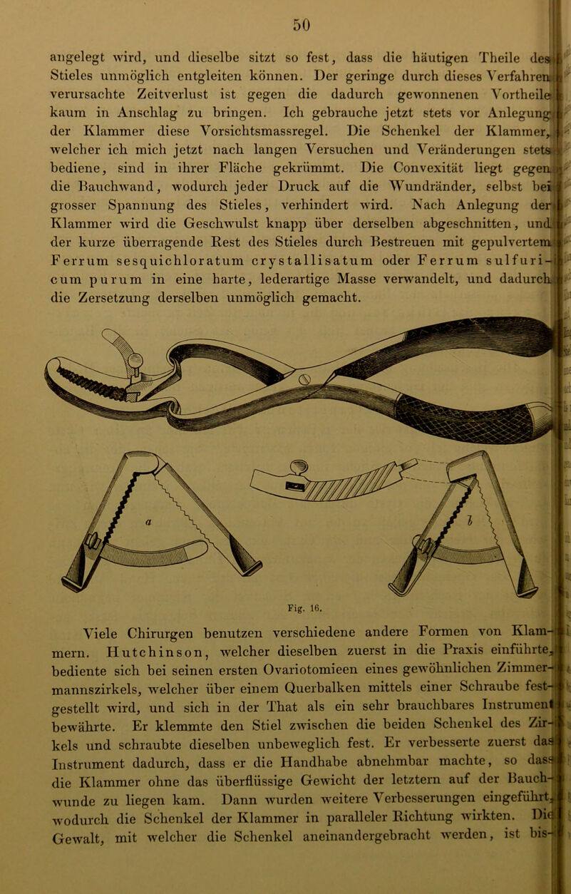 angelegt wird, und dieselbe sitzt so fest, dass die häutigen Theile des Stieles unmöglich entgleiten können. Der geringe durch dieses Verfahrend verursachte Zeitverlust ist gegen die dadurch gewonnenen Vortheilei \ kaum in Anschlag zu bringen. Ich gebrauche jetzt stets vor Anlegung) der Klammer diese Vorsichtsmassregel. Die Schenkel der Klammer, welcher ich mich jetzt nach langen Versuchen und Veränderungen stets * bediene, sind in ihrer Fläche gekrümmt. Die Convexität liegt gegen* die Bauchwand, wodurch jeder Druck auf die Wundränder, selbst ber* grosser Spannung des Stieles, verhindert wird. Nach Anlegung den Klammer wird die Geschwulst knapp über derselben abgeschnitten , undj der kurze überragende Rest des Stieles durch Bestreuen mit gepulvertem Ferrum sesquichloratum crystallisatum oder Ferrum sulfuri-i| cum purum in eine harte, lederartige Masse verwandelt, und dadurchJ die Zersetzung derselben unmöglich gemacht. Fig. 16. Viele Chirurgen benutzen verschiedene andere Formen von Klam- mern. Hutchinson, welcher dieselben zuerst in die Praxis einführte, bediente sich bei seinen ersten Ovariotomieen eines gewöhnlichen Zimmer- mannszirkels, welcher über einem Querbalken mittels einer Schraube fest- gestellt wird, und sich in der That als ein sehr brauchbares Instrument bewährte. Er klemmte den Stiel zwischen die beiden Schenkel des Zir- kels und schraubte dieselben unbeweglich fest. Er verbesserte zuerst dj Instrument dadurch, dass er die Handhabe abnehmbar machte, so dass die Klammer ohne das überflüssige Gewicht der letztem auf der Bauch- wunde zu liegen kam. Dann wurden weitere Verbesserungen eingefülirt., wodurch die Schenkel der Klammer in paralleler Richtung wirkten. Dif Gewalt, mit welcher die Schenkel aneinandergebracht werden, ist bis-