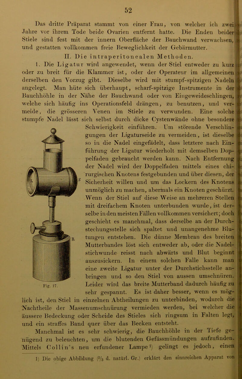 Das dritte Präparat stammt von einer Frau, von welcher ich zwei Jahre vor ihrem Tode beide Ovarien entfernt hatte. Die Enden beider Stiele sind fest mit der innern Oberfläche der Bauchwand verwachsen, und gestatten vollkommen freie Beweglichkeit der Gebärmutter. II. Die intraperitonealen Methoden. 1. Die Ligatur wird angewendet, wenn der Stiel entweder zu kurz oder zu breit für die Klammer ist, oder der Operateur im allgemeinen derselben den Vorzug gibt. Dieselbe wird mit stumpf-spitzigen Nadeln angelegt. Man hüte sich überhaupt, scharf-spitzige Instrumente in der Bauchhöhle in der Nähe der Bauchwand oder von Eingeweideschlingen, welche sich häufig ins Operationsfeld drängen, zu benutzen, und ver- meide , die grösseren Venen im Stiele zu verwunden. Eine solche stumpfe Nadel lässt sich selbst durch dicke Cystenwände ohne besondere Schwierigkeit einführen. Um störende Verschlin- gungen der Ligaturseide zu vermeiden, ist dieselbe so in die Nadel eingefädelt, dass letztere nach Ein- führung der Ligatur wiederholt mit demselben Dop- pelfaden gebraucht werden kann. Nach Entfernung der Nadel wird der Doppelfaden mittels eines chi- rurgischen Knotens festgebunden und über diesen, der Sicherheit willen und um das Lockern des Knotens unmöglich zu machen, abermals ein Knoten geschürzt. Wenn der Stiel auf diese Weise an mehreren Stellen mit dreifachem Knoten unterbunden wurde, ist der- selbe in den meisten Fällen vollkommen versichert; doch geschieht es manchmal, dass derselbe an der Durch- stechungsstelle sich spaltet und unangenehme Blu- tungen entstehen. Die dünne Membran des breiten Mutterbandes löst sich entweder ab, oder die Nadel- stichwunde reisst nach abwärts und Blut beginnt auszusickern. In einem solchen Falle kann man eine zweite Ligatur unter der Durchstichsstelle an- bringen und so den Stiel von aussen umschnüren. Leider wird das breite Mutterband dadurch häufig zu sehr gespannt. Es ist daher besser, wenn es mög- einzelnen Abtheilungen zu unterbinden, wodurch die Fig. 17. lieh ist, den Stiel in j . Nachtheile der Massenumschnürung vermieden werden, bei welcher die äussere Bedeckung oder Scheide des Stieles sich ringsum in Falten legt, und ein straffes Band quer über das Becken entsteht. Manchmal ist es sehr schwierig, die Bauchhöhle in der 'liefe ge- nügend zu beleuchten, um die blutenden Gefässmündungen aufzufinden. Mittels Collin’s neu erfundener Lampe1) gelingt es jedoch, einen I) Die obige Abbildung (2/3 d. natürl. Gr.) erklärt den sinnreichen Apparat von