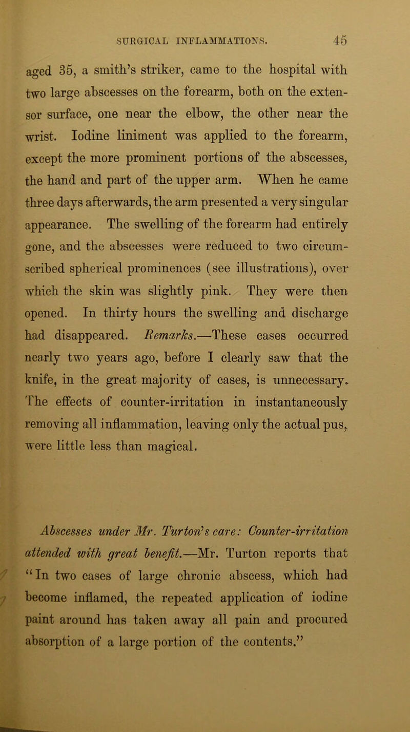 aged 35, a smith’s striker, came to the hospital with two large abscesses on the forearm, both on the exten- sor surface, one near the elbow, the other near the wrist. Iodine liniment was applied to the forearm, except the more prominent portions of the abscesses, the hand and part of the upper arm. When he came three days afterwards, the arm presented a very singular appearance. The swelling of the forearm had entirely 2one, and the abscesses were reduced to two circum- scribed spherical prominences (see illustrations), over which the skin was slightly pink. They were then opened. In thirty hours the swelling and discharge had disappeared. Remarks.—These cases occurred nearly two years ago, before I clearly saw that the knife, in the great majority of cases, is unnecessary. The effects of counter-irritation in instantaneously removing all inflammation, leaving only the actual pus, were little less than magical. Abscesses under Mr. Burton’s care: Counter-irritation attended with great benefit.—Mr. Turton reports that “In two cases of large chronic abscess, which had become inflamed, the repeated application of iodine paint around has taken away all pain and procured absorption of a large portion of the contents.”