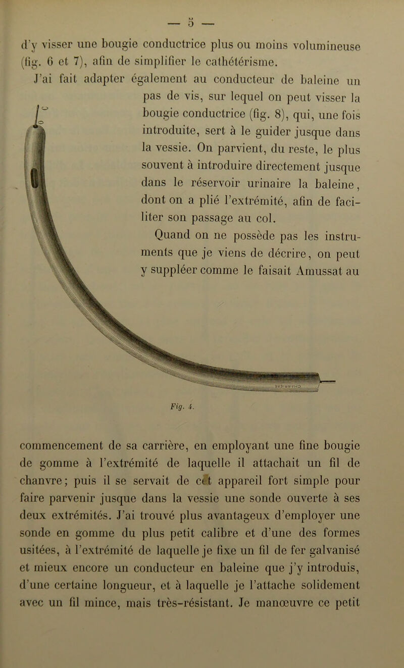 M — 0 d’y visser une bougie conductrice plus ou moins volumineuse (lig. 0 et 7), afin de simplifier le cathétérisme. J’ai fait adapter également au conducteur de baleine un pas de vis, sur lequel on peut visser la bougie conductrice (fig. 8), qui, une fois introduite, sert à le guider jusque dans la vessie. On parvient, du reste, le plus souvent à introduire directement jusque dans le réservoir urinaire la baleine, dont on a plié l’extrémité, afin de faci- liter son passage au col. Quand on ne possède pas les instru- ments que je viens de décrire, on peut y suppléer comme le faisait Amussat au Fig. 4. commencement de sa carrière, en employant une fine bougie de gomme à l’extrémité de laquelle il attachait un fil de chanvre; puis il se servait de ett appareil fort simple pour faire parvenir jusque dans la vessie une sonde ouverte à ses deux extrémités. J’ai trouvé plus avantageux d’employer une sonde en gomme du plus petit calibre et d’une des formes usitées, à l’extrémité de laquelle je fixe un fil de fer galvanisé et mieux encore un conducteur en baleine que j’y introduis, d’une certaine longueur, et à laquelle je l’attache solidement avec un fil mince, mais très-résistant. Je manœuvre ce petit