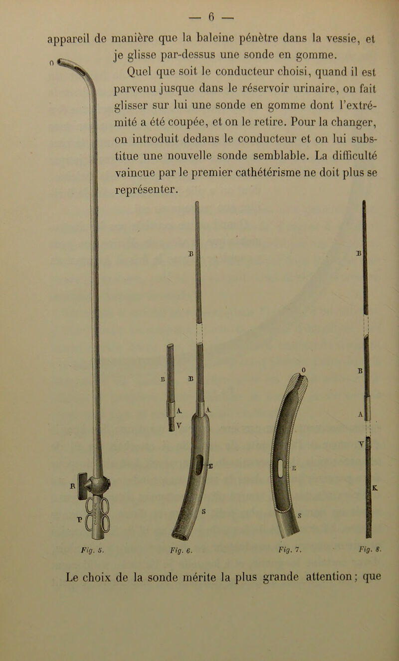 appareil de manière que la baleine pénètre dans la vessie, et je glisse par-dessus une sonde en gomme. Quel que soit le conducteur choisi, quand il est parvenu jusque dans le réservoir urinaire, on fait glisser sur lui une sonde en gomme dont l’extré- mité a été coupée, et on le retire. Pour la changer, on introduit dedans le conducteur et on lui subs- titue une nouvelle sonde semblable. La difficulté vaincue par le premier cathétérisme ne doit plus se représenter. Fig. S. Fig. 6. Fig. 7. Fig. S. Le choix de la sonde mérite la plus grande attention ; que