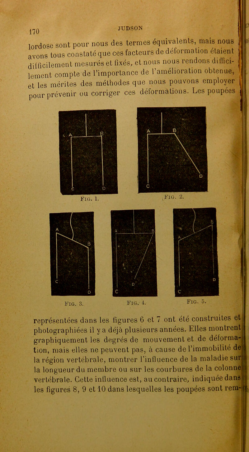 lordose sont pour nous des termes équivalents, mais nous avons tous constaté que ces facteurs de déformation étaient difficilement mesurés et fixés, et nous nous rendons diffici- lement compte de l’importance de l’amélioration obtenue, et les mérites des méthodes que nous pouvons employer pour prévenir ou corriger ces déformations. Les poupées fl1- représentées dans les figures 6 et 7 ont été construites et photographiées il y a déjà plusieurs années. Elles montrent graphiquement les degrés de mouvement et de déforma- tion, mais elles ne peuvent pas, à cause de l’immobilité de la région vertébrale, montrer l’influence de la maladie sur la longueur du membre ou sur les courbures de la colonne vertébrale. Cette influence est, au contraire, indiquée dans les figures 8, 9 et 10 dans lesquelles les poupées sont rem-