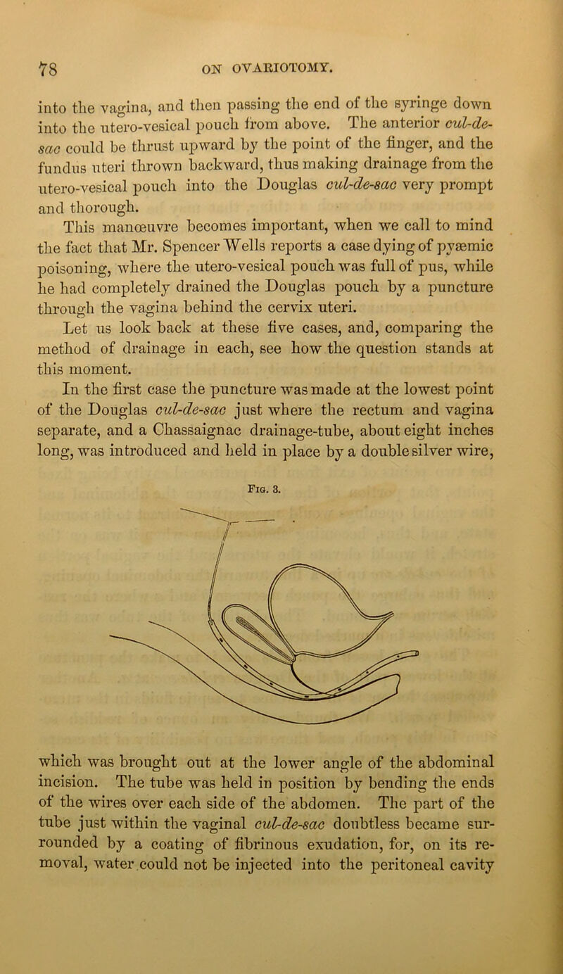 into the vagina, and then passing the end of the syringe down into the utero-vesical pouch from above. The anterior cul-de- sac could be thrust upward by the point of the finger, and the fundus uteri thrown backward, thus making drainage from the utero-vesical pouch into the Douglas cul-de-sac very prompt and thorough. This manoeuvre becomes important, when we call to mind the fact that Mr. Spencer Wells reports a case dying of py£emic poisoning, where the utero-vesical pouch was full of pus, while he had completely drained the Douglas pouch by a puncture through the vagina behind the cervix uteri. Let us look back at these five cases, and, comparing the method of drainage in each, see how the question stands at this moment. In the first case the puncture was made at the lowest point of the Douglas cul-de-sac just where the rectum and vagina separate, and a Chassaignac drainage-tube, about eight inches long, was introduced and held in place by a double silver wire, Fig. 3. which was brought out at the lower angle of the abdominal incision. The tube was held in position by bending the ends of the wires over each side of the abdomen. The part of the tube just within the vaginal cul-de-sac doubtless became sur- rounded by a coating of fibrinous exudation, for, on its re- moval, water could not be injected into the peritoneal cavity