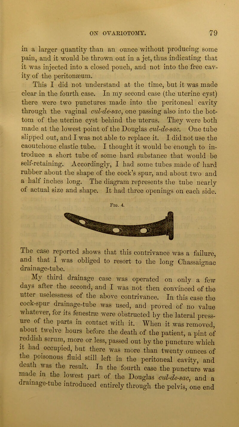 in a larger quantity than an ounce without producing some pain, and it would be thrown out in a jet, thus indicating that it was injected into a closed pouch, and not into the free cav- ity of the peritonteum. This I did not understand at the time, but it was made clear in the fourth case. In my second case (the uterine cyst) there were two punctures made into the peritoneal cavity through the vaginal cul-de-sac, one passing also into the bot- tom of the uterine cyst behind the uterus. They were both made at the lowest point of the Douglas cul-de-sac. One tube slipped out, and I was not able to replace it. I did not use the caoutchouc elastic tube. I thought it would be enough to in- troduce a short tube of some hard substance that would be self-retaining. Accordingly, I had some tubes made of hard rubber about the shape of the cock’s spur, and about two and a half inches long. The diagram represents the tube nearly ot actual size and shape. It had three openings on each side. Fig. 4. The case reported shows that this contrivance was a failure, and that I was obliged to resort to the long Chassaignac drainage-tube. My third drainage case was operated on only a few days after the second, and I was not then convinced of the utter uselessness of the above contrivance. In this case the cock-spur drainage-tube was used, and proved of no value whatever, for its fenestrse were obstructed by the lateral press- uie of the parts in contact with it. When it was removed, about twelve hours before the death of the patient, a pint of reddish serum, more or less, passed out by the puncture which it a occupied, but there was more than twenty ounces of t ie poisonous fluid still left in the peritoneal cavity, and eat 1 vas the lesult. In the fourth case the puncture was made in the lowest part of the Douglas cul-de-sac, and a C ramage'tube introduced entirely through the pelvis, one end