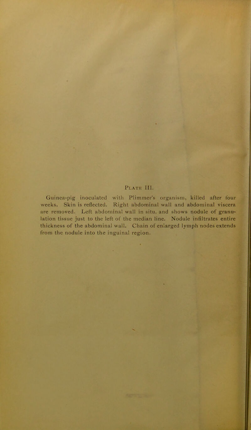 Guinea-pig inoculated with Plimmer’s organism, killed after four weeks. Skin is reflected. Right abdominal wall and abdominal viscera are removed. Left abdominal wall in situ, and shows nodule of granu- lation tissue just to the left of the median line. Nodule infiltrates entire thickness of the abdominal wall. Chain of enlarged lymph nodes extends from the nodule into the inguinal region.