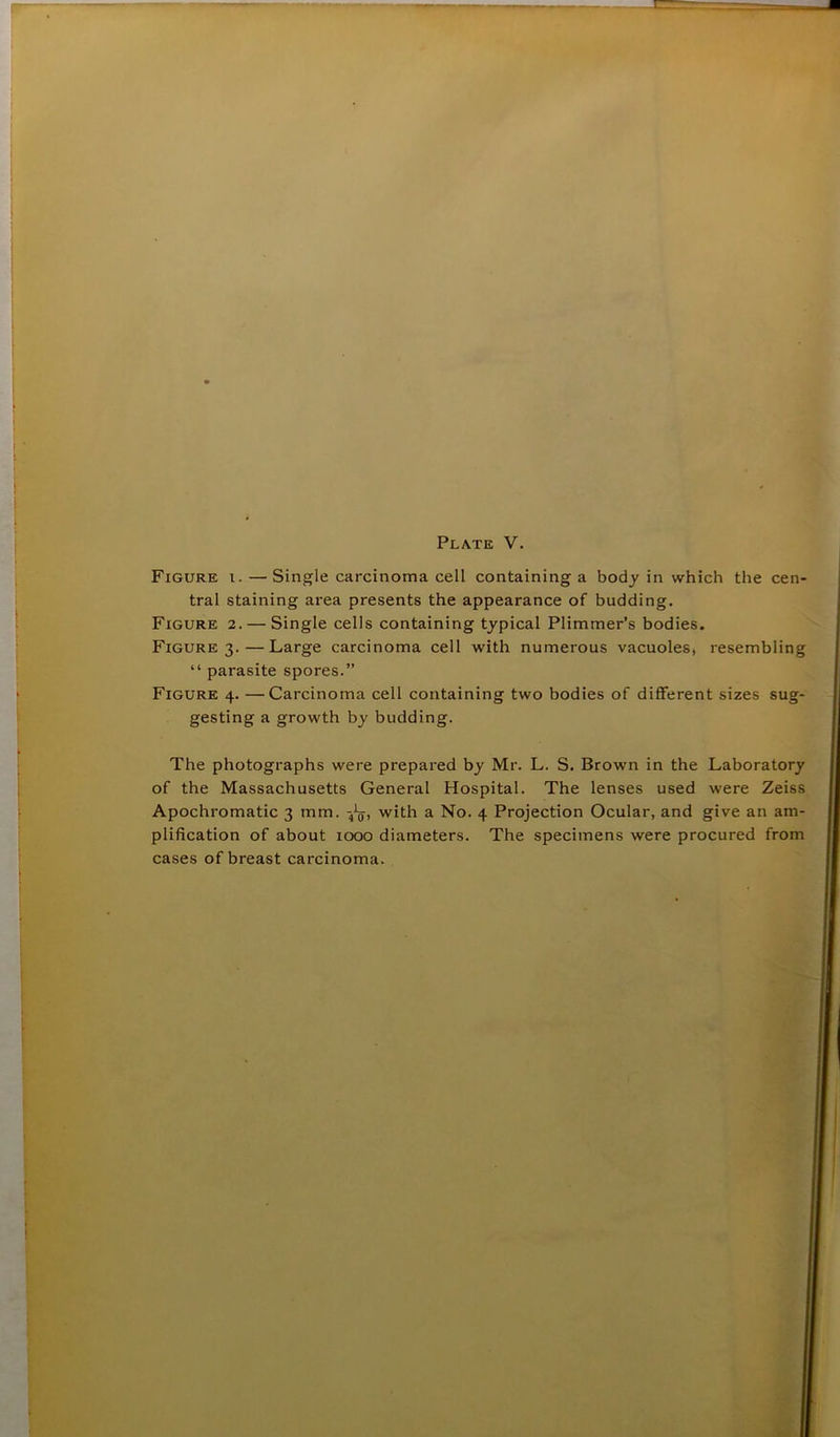 Figure i. — Single carcinoma cell containing a body in which the cen- tral staining area presents the appearance of budding. Figure 2.— Single cells containing typical Plimmer’s bodies. Figure 3.—Large carcinoma cell with numerous vacuolesj resembling “ parasite spores.” Figure 4. —Carcinoma cell containing two bodies of different sizes sug- gesting a growth by budding. The photographs were prepared by Mr. L. S. Brown in the Laboratory of the Massachusetts General Hospital. The lenses used were Zeiss Apochromatic 3 mm. -41q, with a No. 4 Projection Ocular, and give an am- plification of about 1000 diameters. The specimens were procured from cases of breast carcinoma.