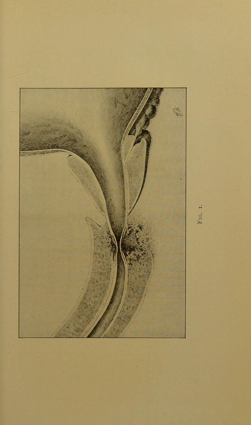 Fig.