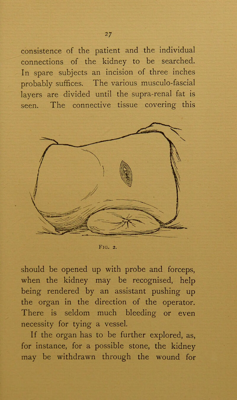 consistence of the patient and the individual connections of the kidney to be searched. In spare subjects an incision of three inches probably suffices. The various musculo-fascial layers are divided until the supra-renal fat is seen. The connective tissue covering this should be opened up with probe and forceps, when the kidney may be recognised, help being rendered by an assistant pushing up the organ in the direction of the operator. There is seldom much bleeding or even necessity for tying a vessel. If the organ has to be further explored, as, for instance, for a possible stone, the kidney may be withdrawn through the wound for