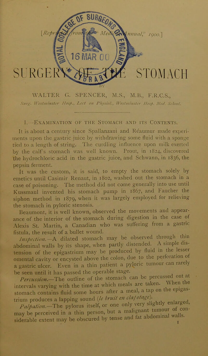 I’.V WALTER (L SPENCER, M.S., M.H., F.R.C.S., U'l'ihtthtsiir !fos/>., Lcct on Physiol., Westiiii>isicr Jlos/>. Med. SrhooL I.—Examination of the Stomach and its Contents. It is about a century since Spallanzani and Reaumur made experi- ments upon the gastric juice by withdrawing some fluid with a sponge tFed to a length of string. The curdling influence upon milk exerted by the calfs stomach was well known. Prout, in 1824, discovered the hydrochloric acid in the gastric juice, and Schwann, in 1836, the pepsin ferment. It was the custom, it is said, to empty the stomach solely by emetics until Casimir Renaut, in 1802, washed out the stomach in a case of poisoning. The method did not come generally into use until Kussmaul invented his stomach pump in 1867, and Faucher the siphon method in i879> R largely employed for relieving the stomach in pyloric stenosis. Beaumont, it is well known, observed the movements and appeal- ance of the interior of the stomach during digestion in the case of Alexis St. Martin, a Canadian who was suffering from a gastric fistula, the result of a bullet wound. Inspection.—k dilated stomach may be observed through thin abdominal walls by its shape, when partly distended. A simple dis- tension of the epigastrium may be produced by fluid in the lesser omental cavity or encysted above the colon, due to the peifoiation o a gastric ulcer. Plven in a thin patient a pyjoiic tumoui can laic ) be seen until it has passed the operable stage. Percussion.—outline of the stomacli can be percussed out a intervals varying with the time at which meals aie taken. len stomach contains fluid some hours after a meal, a tap on t le epi^as trium produces a lapping sound {le bruit en clafotai^e). 7^./J.//.«.-The pylorus itself, or one only very slightly enlaige , may be perceived in a thin person, but a malignant siderable extent may be obscured by tense and fat a jc