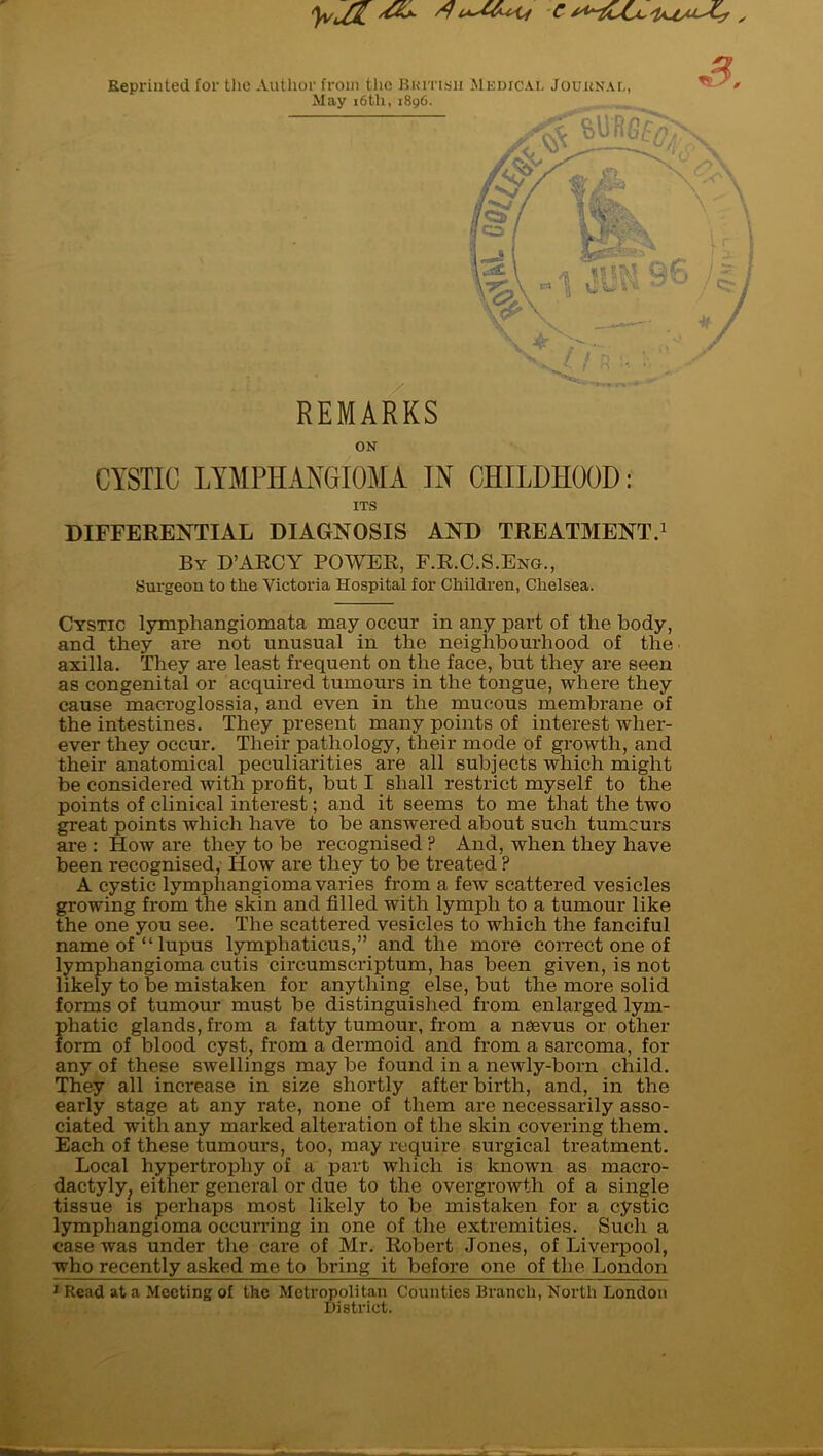 Reprinted Tor the Author from the Rumsii Mkdical JouitNAL, May i6th, 1896. ^ REMARKS ON CYSTIC LYMPHAKGIOMA IN CHILDHOOD: ITS DIFFERENTIAL DIAGNOSIS AND TREATMENT.^ By D’ARCY power, F.R.C.S.Eng., Surgeon to the Victoria Hospital for Children, Chelsea. Cystic lymphangiomata may occur in any part of the body, and they are not unusual in the neighbourhood of the axilla. They are least frequent on the face, hut they are seen as congenital or acquired tumours in the tongue, where they cause macroglossia, and even in the mucous membrane of the intestines. They present many points of interest wher- ever they occur. Their pathology, their mode of growth, and their anatomical peculiarities are all subjects which might be considered with profit, but I shall restrict myself to the points of clinical interest; and it seems to me that the two great points which have to be answered about such tumeurs are : How ai*e they to be recognised ? And, when they have been recognised. How are they to be treated ? A cystic lymphangioma varies from a few scattered vesicles growing from the skin and filled with lymph to a tumour like the one you see. The scattered vesicles to which the fanciful name of “lupus lymphaticus,” and the more correct one of lymphangioma cutis circumscriptum, has been given, is not likely to be mistaken for anything else, but the more solid forms of tumour must be distinguished from enlarged lym- phatic glands, from a fatty tumour, from a nsevus or other form of blood cyst, from a dermoid and from a sarcoma, for any of these swellings may be found in a newly-born child. They all increase in size shortly after birth, and, in the early stage at any rate, none of them are necessarily asso- ciated with any marked alteration of the skin covering them. Each of these tumours, too, may require surgical treatment. Local hypertrophy of a part which is known as macro- dactyly^ either general or due to the overgrowth of a single tissue IS perhaps most likely to be mistaken for a cystic lymphangioma occun’ing in one of the extremities. Such a case was under the care of Mr. Robert Jones, of Liverpool, who recently asked me to bring it before one of the London ^ Read at a Meeting of the Metropolitan Counties Branch, North London District.