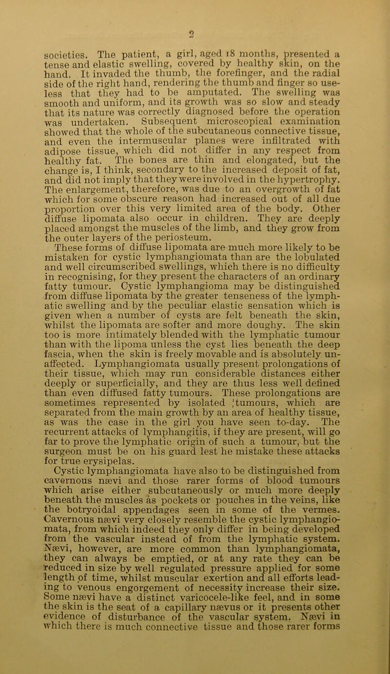 o societies. The patient, a girl, aged i8 montlis, presented a tense and elastic swelling, covered by healthy skin, on the hand. It invaded the thumb, the forefinger, and the radial side of the right hand, rendering the thumb and finger so use- less that they had to be amputated. The swelling was smooth and uniform, and its growth was so slow and steady that its nature was correctly diagnosed before the operation was undertaken. Subsequent microscopical examination showed that the whole of the subcutaneous connective tissue, and even the intermuscular planes were infiltrated with adipose tissue, which did not differ in any respect from healthy fat. The bones are thin and elongated, but the change is, I think, secondary to the increased deposit of fat, and did not imply that they were involved in the hypertrophy. The enlargement, therefore, was due to an overgrowth of fat which for some oljscure reason had increased out of all due proportion over this very liniited area of the body. Other difi'use lipomata also occur in children. They are deeply placed amongst the muscles of the limb, and they grow from the outer layers of the periosteum. These forms of diflfuse lipomata are much more likely to be mistaken for cystic lymphangiomata than are the lobulated and well circumscribed swellings, which there is no difiiculty in recognising, for they present the characters of an ordinary fatty tumour. Cystic lymphangioma may be distinguished from difi'use lipomata by the greater tenseness of the lymph- atic swelling and by the peculiar elastic sensation which is given when a number of cysts are felt beneath the skin, whilst the lipomata are softer and more doughy. The skin too is more intimately blended with the lymphatic tumour than with the lipoma unless the cyst lies beneath the deep fascia, when the skin is freely movable and is absolutely un- afiected. Lymphangiomata usually present prolongations of their tissue, which may run considerable distances either deeply or superficially, and they are thus less well defined than even difiused fatty tumours. These prolongations are sometimes represented by isolated tumours, which are separated from the main growth by an area of healthy tissue, as was the case in the girl you have seen to-day. The recurrent attacks of lymphangitis, if they are present, will go far to prove the lymphatic origin of such a tumour, but the surgeon must be on his guard lest he mistake these attacks for true erysipelas. Cystic lymphangiomata have also to be distinguished from cavernous nsevi and those rarer forms of blood tumours which arise either subcutaneously or much more deeply beneath the muscles as pockets or pouches in the veins, like the botryoidal appendages seen in some of the vermes. Cavernous nsevi very closely resemble the cystic lymphangio- mata, from which indeed they only difier in being developed from the vascular instead of from the lymphatic system. Nsevi, however, are more common than lymphangiomata, they can always be emptied, or at any rate they can be reduced in size by well regulated pressure applied for some length of time, whilst muscular exertion and all efiorts lead- ing to venous engorgement of necessity increase their size. Some nsevi have a distinct varicocele-like feel, and in some the skin is the seat of a capillary nsevus or it presents other evidence of disturbance of the vascular system. Nsevi in which there is much connective tissue and those rarer forms