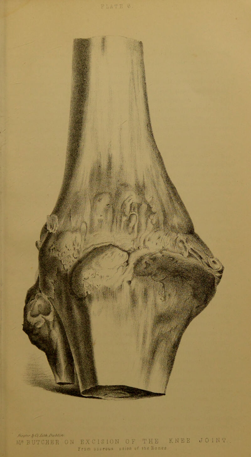 /f f.ytfr fyf.Q /fth /l I/O//ft from osseous union of the Bones