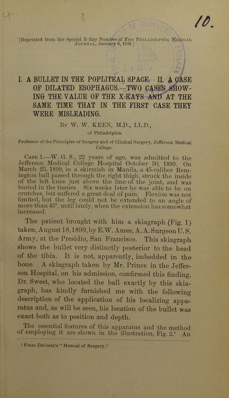 6 o [Reprinted from the Special X-Ray Number of Tiik Philadelphia Medical Journal, January 6, 1900.] I. A BULLET IN THE POPLITEAL SPACE. H. A CASE OF DILATED ESOPHAGUS.—TWO CASES SHOW- ING THE VALUE OF THE X-RAYS AND AT THE SAME TIME THAT IN THE FIRST CASE THEY WERE MISLEADING. By W. W. keen, M.D., LL.D., of Philadelphia. Professor of the Principles of Surgery and of Clinical Surgery, Jefferson Medical College. Case 1.—W. G. S., 22 years of age, was admitted to the Jefferson Medical College Hospital October 30, 1899. On March 25, 1899, in a skirmish in Manila, a 45-caliber Rem- ington ball passed through the right thigh; struck the inside of the left knee just above the line of the joint, and was buried in the tissues. Six weeks later he was able to be on crutches, but sutfered a great deal of pain. Flexion was not limited, but the leg could not be extended to an angle of more than 45°, until lately, when the extension has somewhat increased. The patient brought with him a skiagraph (Fig. 1) taken, August 18,1899, by E. W. Ames, A. A. Surgeon U. S. Army, at the Presidio, San Francisco. This skiagraph shows the bullet very distinctly posterior to the head of the tibia. It is not, apparently, imbedded in the bone. A skiagraph taken by Mr. Prince in the Jeffer- son Hospital, on his admission, confirmed this finding. Dr. Sweet, who located the ball exactly by this skia- graph, has kindly furnished me with the following description of the application of his localizing appa- ratus and, as will be seen, his location of the bullet was exact both as to position and depth. The essential features of this apparatus and the method of employing it are shown in the illustration, Fig. 2.^ An ' From DaCosta’s “Manual of Surgery.’’