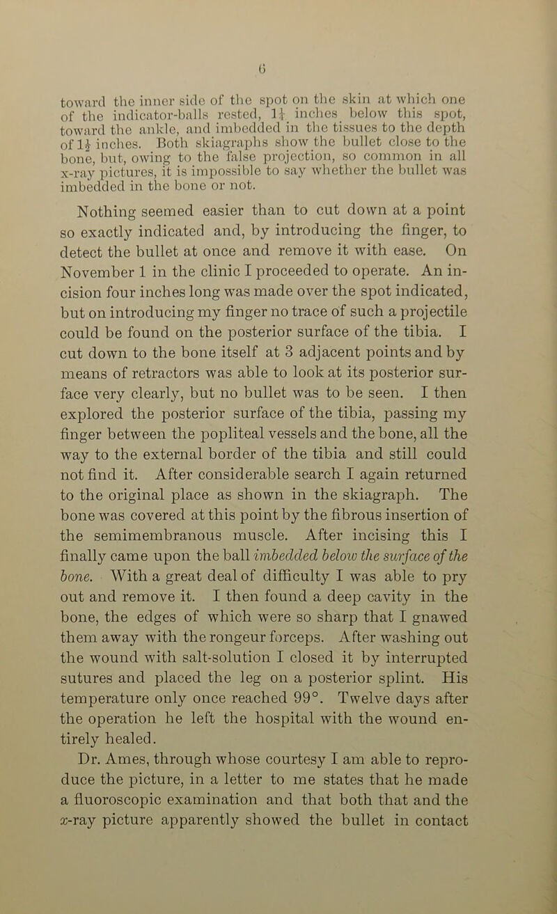 G toward the inner side of the spot on the skin at which one of the indicator-balls rested, U inches below this spot, toward the ankle, and imbedded in the tissues to the depth of IJ inches. Both skiagraphs show the bullet close to the bone, but, owing to the flilse projection, so common in all X-ray pictures, it is impossible to say whether the bullet was imbedded in the bone or not. Nothing seemed easier than to cut down at a point so exactly indicated and, by introducing the finger, to detect the bullet at once and remove it with ease. On November 1 in the clinic I proceeded to operate. An in- cision four inches long was made over the spot indicated, but on introducing my finger no trace of such a projectile could be found on the posterior surface of the tibia. I cut down to the bone itself at 3 adjacent points and by means of retractors was able to look at its posterior sur- face very clearly, but no bullet was to be seen. I then explored the posterior surface of the tibia, passing my finger between the popliteal vessels and the bone, all the way to the external border of the tibia and still could not find it. After considerable search I again returned to the original place as shown in the skiagraph. The bone was covered at this point by the fibrous insertion of the semimembranous muscle. After incising this I finally came upon the ball imbedded below the surface of the bone. With a great deal of difficulty I was able to pry out and remove it. I then found a deep cavity in the bone, the edges of which were so sharp that I gnawed them away with the rongeur forceps. After washing out the wound with salt-solution I closed it by interrupted sutures and placed the leg on a posterior splint. His temperature only once reached 99°. Twelve days after the operation he left the hospital with the wound en- tirely healed. Dr. Ames, through whose courtesy I am able to repro- duce the picture, in a letter to me states that he made a fluoroscopic examination and that both that and the x-ray picture apparently showed the bullet in contact