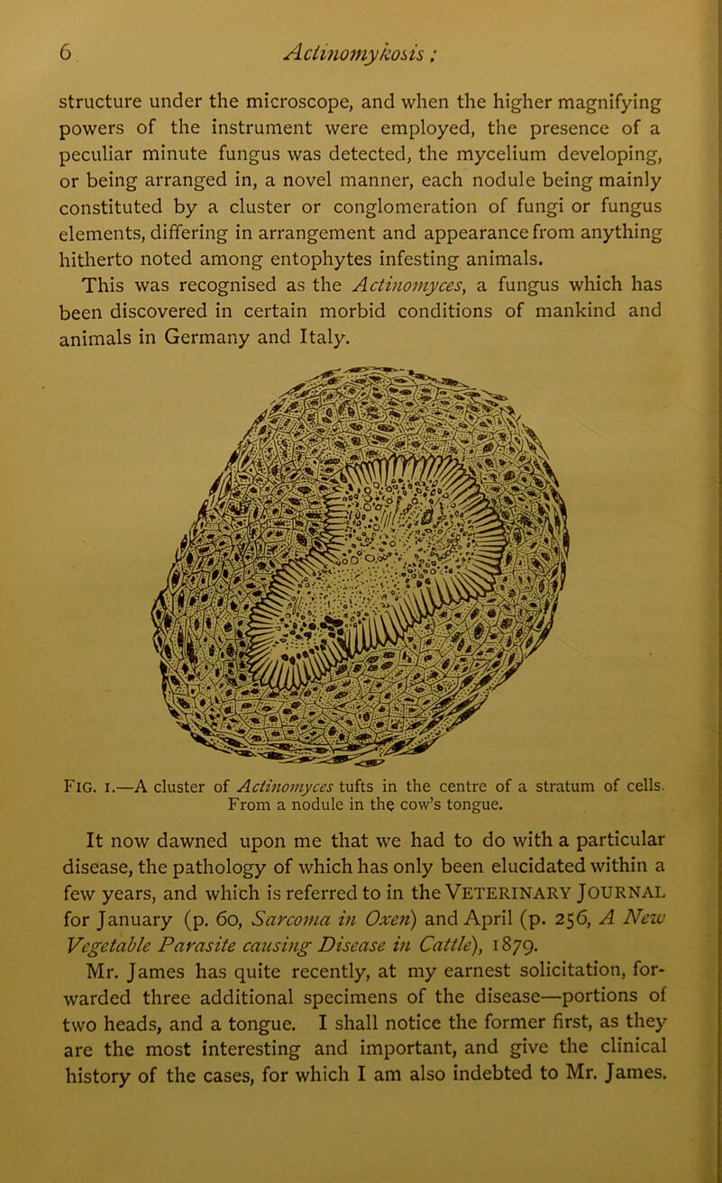 structure under the microscope, and when the higher magnifying powers of the instrument were employed, the presence of a peculiar minute fungus was detected, the mycelium developing, or being arranged in, a novel manner, each nodule being mainly constituted by a cluster or conglomeration of fungi or fungus elements, differing in arrangement and appearance from anything hitherto noted among entophytes infesting animals. This was recognised as the Actinomyces, a fungus which has been discovered in certain morbid conditions of mankind and animals in Germany and Italy. Fig. i.—A cluster of Actinomyces tufts in the centre of a stratum of cells. From a nodule in the cow’s tongue. It now dawned upon me that we had to do with a particular disease, the pathology of which has only been elucidated within a few years, and which is referred to in the VETERINARY JOURNAL for January (p. 60, Sarcoma in Oxen) and April (p. 256, A New Vegetable Parasite causing Disease in Cattle), 1879. Mr. James has quite recently, at my earnest solicitation, for- warded three additional specimens of the disease—portions of two heads, and a tongue. I shall notice the former first, as they are the most interesting and important, and give the clinical history of the cases, for which I am also indebted to Mr. James.