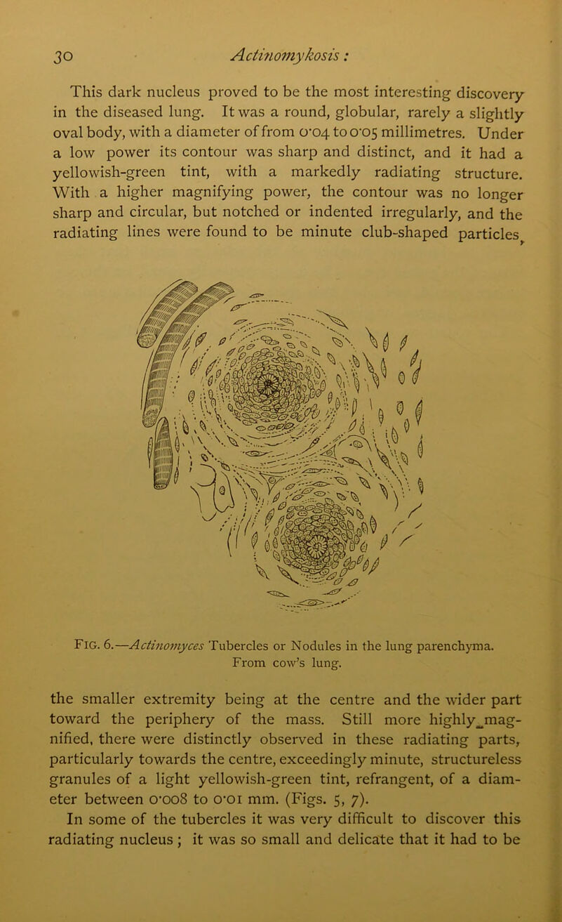 This dark nucleus proved to be the most interesting discovery- in the diseased lung. It was a round, globular, rarely a slightly oval body, with a diameter of from 0-04 to o-c>5 millimetres. Under a low power its contour was sharp and distinct, and it had a yellowish-green tint, with a markedly radiating structure. With a higher magnifying power, the contour was no longer sharp and circular, but notched or indented irregularly, and the radiating lines were found to be minute club-shaped particles Fig. 6.—Actinomyces Tubercles or Nodules in the lung parenchyma. From cow’s lung. the smaller extremity being at the centre and the wider part toward the periphery of the mass. Still more highly^mag- nified, there were distinctly observed in these radiating parts, particularly towards the centre, exceedingly minute, structureless granules of a light yellowish-green tint, refrangent, of a diam- eter between crooS to croi mm. (Figs. 5, 7). In some of the tubercles it was very difficult to discover this radiating nucleus; it was so small and delicate that it had to be