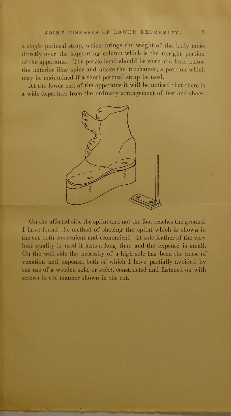 a single perineal strap, which brings the weight of the body more directly over the supporting column which is the upright portion of the apparatus. The pelvic band should be worn at a level below the anterior iliac spine and above the trochanter, a position which may be maintained if a short perineal strap be used. At the lower end of the apparatus it will be noticed that there is a wide departure from the ordinary arrangement of feet and shoes. On the affected side the splint and not the foot reaches the ground. I have found the method of shoeing the splint which is shown in the cut both convenient and economical. If sole leather of the very best quality is used it lasts a long time and the expense is small. On the well side the necessity of a high sole has been the cause of vexation and expense, both of which I have partially avoided by the use of a wooden sole, or sabot, constructed and fastened ou with screws in the mauner shown in the cut.