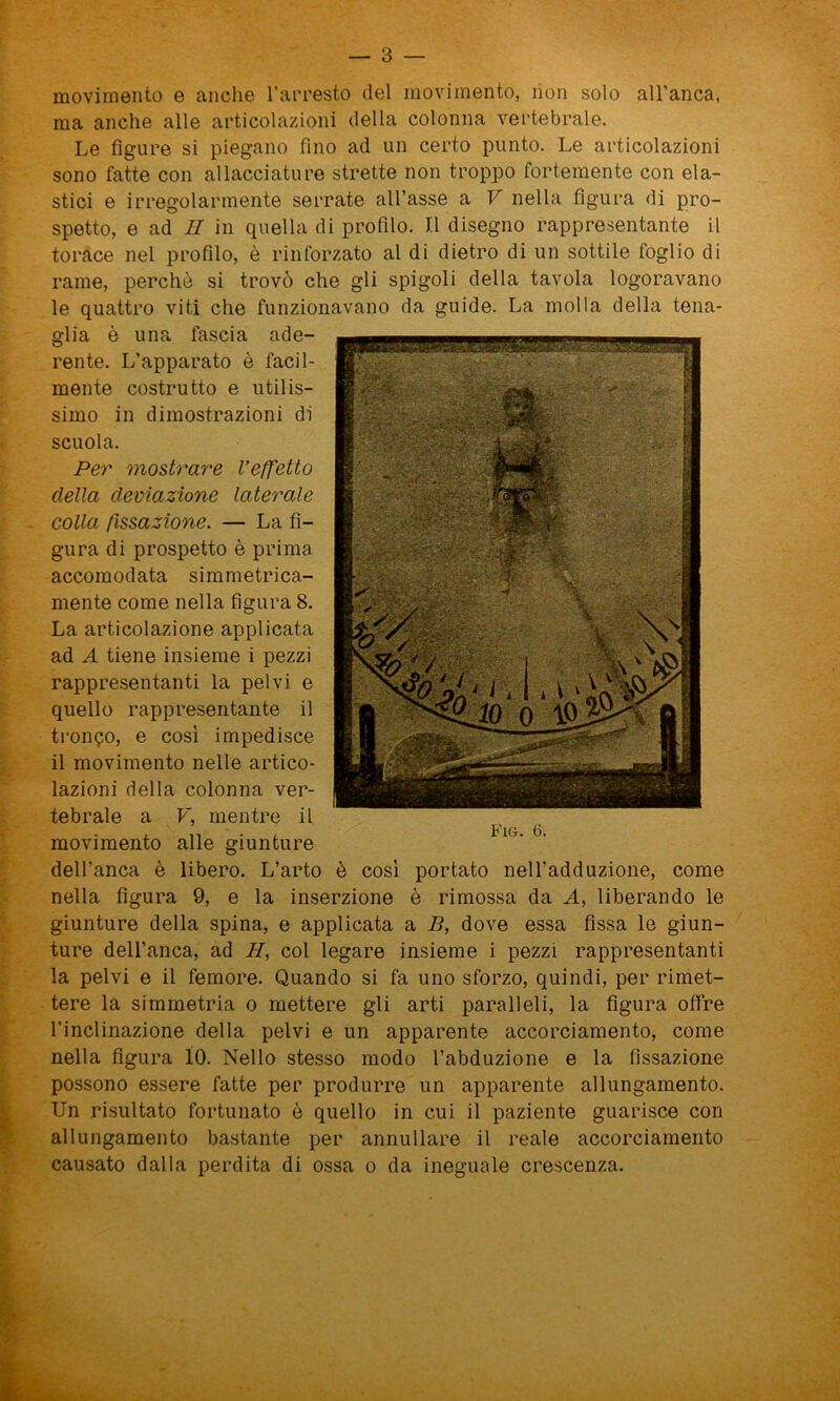 movimento e anche l’arresto del movimento, non solo all’anca, ma anche alle articolazioni della colonna vertebrale. Le figure si piegano fino ad un certo punto. Le articolazioni sono fatte con allacciature strette non troppo fortemente con ela- stici e irregolarmente serrate all’asse a V nella figura di pro- spetto, e ad II in quella di profilo. Il disegno rappresentante il torace nel profilo, è rinforzato al di dietro di un sottile foglio di rame, perchè si trovò che gli spigoli della tavola logoravano le quattro viti che funzionavano da guide. La molla della tena- glia è una fascia ade- rente. L’apparato è facil- mente costrutto e utilis- simo in dimostrazioni di scuola. Per mostrare l’effetto della deviazione laterale colla fissazione. — La fi- gura di prospetto è prima accomodata simmetrica- mente come nella figura 8. La articolazione applicata ad A tiene insieme i pezzi rappresentanti la pelvi e quello rappresentante il tronco, e così impedisce il movimento nelle artico- lazioni della colonna ver- tebrale a V, mentre il movimento alle giunture dell’anca è libero. L’arto è così portato nell’adduzione, come nella figura 9, e la inserzione è rimossa da A, liberando le giunture della spina, e applicata a B, dove essa fissa le giun- ture dell’anca, ad H, col legare insieme i pezzi rappresentanti la pelvi e il femore. Quando si fa uno sforzo, quindi, per rimet- tere la simmetria o mettere gli arti paralleli, la figura offre l’inclinazione della pelvi e un apparente accorciamento, come nella figura 10. Nello stesso modo l’abduzione e la fissazione possono essere fatte per produrre un apparente allungamento. Un risultato fortunato è quello in cui il paziente guarisce con allungamento bastante per annullare il reale accorciamento causato dalla perdita di ossa o da ineguale crescenza.
