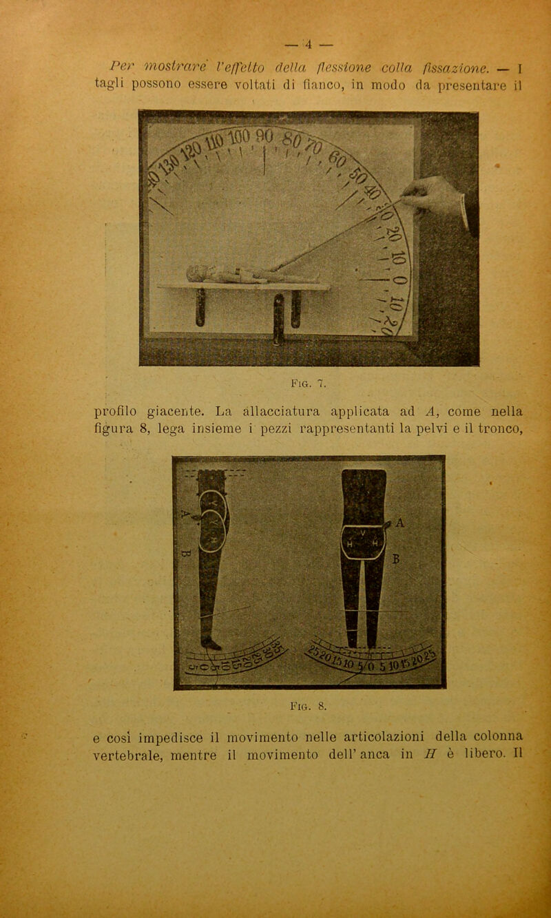 tagli possono essere voltati di fianco, in modo da presentare il Fio. 8. Fig. 7. profilo giacente. La allacciatura applicata ad A, come nella figura 8, lega insieme i pezzi rappresentanti la pelvi e il tronco, già e così impedisce il movimento nelle articolazioni della colonna vertebrale, mentre il movimento dell’anca in II è libero. Il