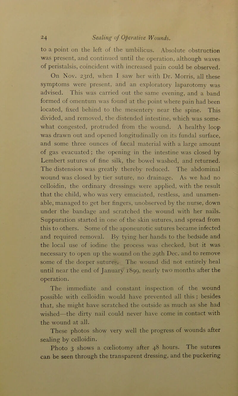 to a point on the left of the umbilicus. Absolute obstruction was present, and continued until the operation, although waves of peristalsis, coincident with increased pain could be observed. On Nov. 23rd, when I saw her with Dr. Morris, all these symptoms were present, and an exploratory laparotomy was advised. This was carried out the same evening, and a band formed of omentum was found at the point where pain had been located, fixed behind to the mesentery near the spine. This divided, and removed, the distended intestine, which was some- what congested, protruded from the wound. A healthy loop was drawn out and opened longitudinally on its fundal surface, and some three ounces of faecal material with a large amount of gas evacuated; the opening in the intestine was closed by Lembert sutures of fine silk, the bowel washed, and returned. The distension was greatly thereby reduced. The abdominal wound was closed by tier suture, no drainage. As we had no celloidin, the ordinary dressings were applied, with the result that the child, who was very emaciated, restless, and unamen- able, managed to get her fingers, unobserved by the nurse, down under the bandage and scratched the wound with her nails. Suppuration started in one of the skin sutures, and spread from this to others. Some of the aponeurotic sutures became infected and required removal. By tying her hands to the bedside and the local use of iodine the process was checked, but it was necessary to open up the wound on the 29th Dec. and to remove some of the deeper sutures. The wound did not entirely heal until near the end of January 1899, nearly two months after the operation. The immediate and constant inspection of the wound possible with celloidin would have prevented all this ; besides that, she might have scratched the outside as much as she had wished—the dirty nail could never have come in contact with the wound at all. These photos show very well the progress of wounds after sealing by celloidin. Photo 3 shows a cceliotomy after 48 hours. The sutures can be seen through the transparent dressing, and the puckering