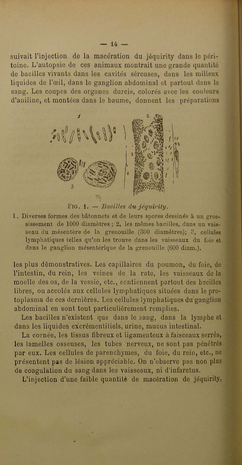 suivait l’injection de la macération du jéquirity dans le péri- toine. L’autopsie de ces animaux montrait une grande quantité de bacilles vivants dans les cavités séreuses, dans les milieux liquides de l’œil, dans le ganglion abdominal et partout dans le sang. Les coupes des organes durcis, colorés avec les couleurs d’aniline, et montées dans le baume, donnent les préparations Fig. 1. — Bacilles du jéquirity. 1. Diverses formes des bâtonnets et de leurs spores dessinés à un gros- sissement de 1000 diamètres ; 2, les mêmes bacilles, dans un vais- seau du mésentère de la grenouille (300 diamètres); 3, cellules ^ lymphatiques telles qu’on les trouve dans les vaisseaux du foie et dans le ganglion mésentérique de la grenouille (600 diam.). ï J les plus démonstratives. Les capillaires du poumon, du foie, de Y l’intestin, du rein, les veines de la rate, les vaisseaux de la >. moelle des os, de la vessie, etc., contiennent partout des bacilles fc libres, ou accolés aux cellules lymphatiques situées dans le pro- % toplasma de ces dernières. Les cellules lymphatiques du^anglion ÿ abdominal en sont tout particulièrement remplies. » Les bacilles n’existent que dans le sang, dans la lymphe et dans les liquides, excrémentitiels, urine, mucus intestinal. 1 La cornée, les tissus fibreux et ligamenteux à faisceaux serrés, 5 les lamelles osseuses, les tubes nerveux, ne sont pas pénétrés ÿ par eux. Les cellules de parenchymes, du foie, du rein, etc., ne ^ présentent pas de lésion appréciable. On n’observe pas non plus de coagulation du sang dans les vaisseaux, ni d’infarctus. L’injection d’une faible quantité de macération de jéquirity, %