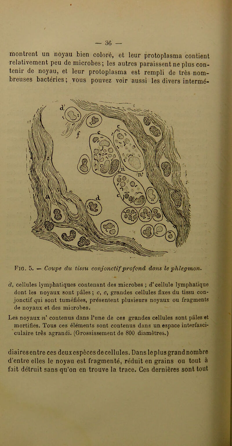 montrent un noyau bien coloré, et leur protoplasraa contient relativement peu de microbes; les autres paraissent ne plus con- tenir de noyau, et leur proloplasma est rempli de très nom- breuses bactéries; vous pouvez voir aussi les divers intermé- Fig. 5. — Coupe du tissu conjonctif profond dons le phlegmon. « d, cellules lymphatiques contenant des microbes ; d’cellule lymphatique dont les noyaux sont pâles; c, c, grandes cellules fixes du tissu con- jonctif qui sont tuméfiées, présentent plusieurs noyaux ou fragments de noyaux et des microbes. Les noyaux n' contenus dans l’une de ces grandes cellules sont pâles et mortifiés. Tous ces éléments sont contenus dans un espace interfasci- culaire très agrandi. (Grossissement de 800 diamètres.) diaires entre ces deux espèces de cellules. Dans leplus grand nombre d’entre elles le noyau est fragmenté, réduit en grains ou tout à fait détruit sans qu’on en trouve la trace. Ces dernières sont tout