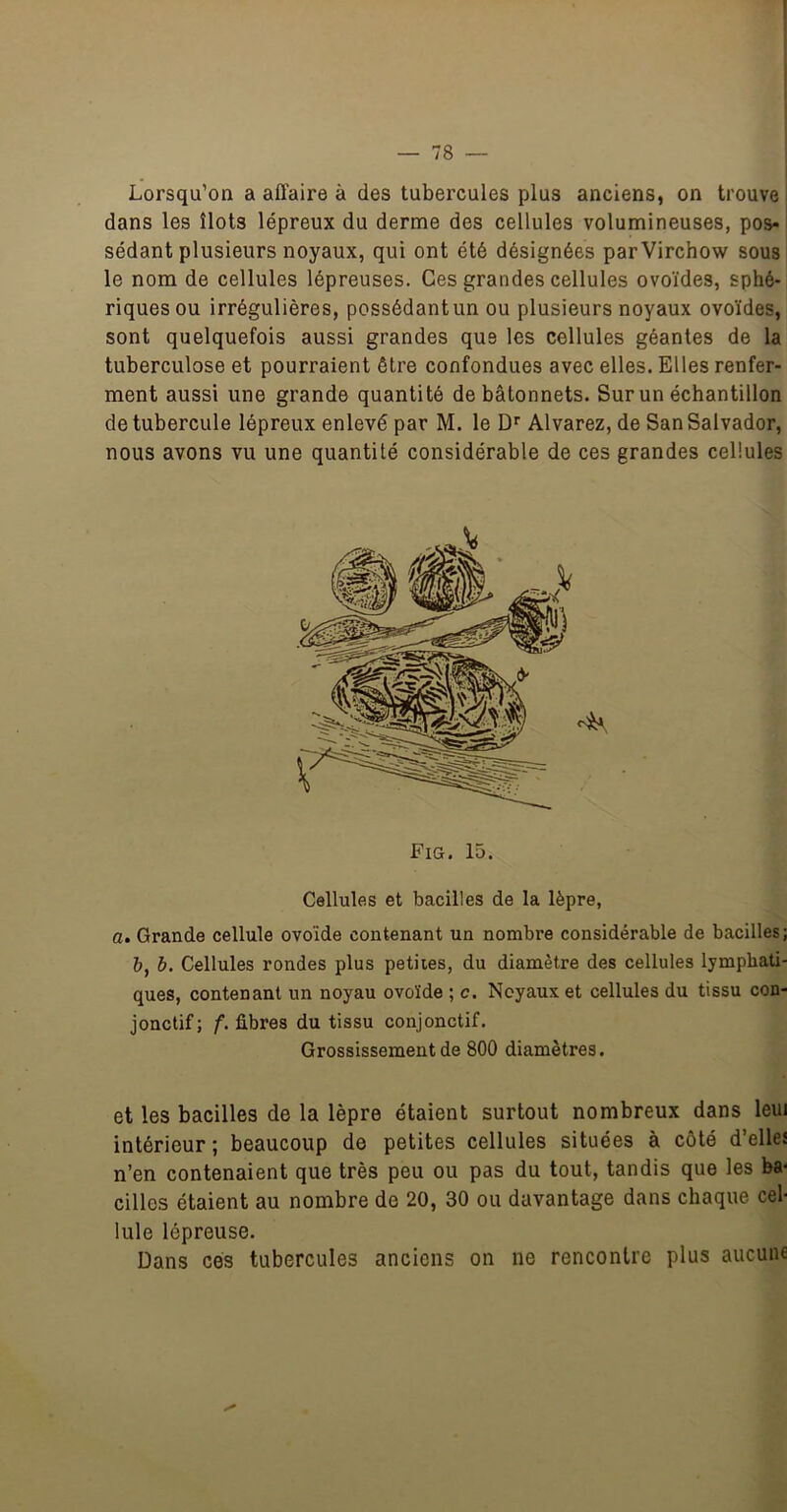 Lorsqu’on a affaire à des tubercules plus anciens, on trouve i dans les îlots lépreux du derme des cellules volumineuses, pos-' sédant plusieurs noyaux, qui ont été désignées par Virchow sousî le nom de cellules lépreuses. Ces grandes cellules ovoïdes, sphé- riques ou irrégulières, possédantun ou plusieurs noyaux ovoïdes, sont quelquefois aussi grandes que les cellules géantes de la tuberculose et pourraient être confondues avec elles. Elles renfer- ment aussi une grande quantité de bâtonnets. Sur un échantillon de tubercule lépreux enlevé par M. le D'' Alvarez, de San Salvador, nous avons vu une quantité considérable de ces grandes cellules Cellules et bacilles de la lèpre, a. Grande cellule ovoïde contenant un nombre considérable de bacilles; &, h. Cellules rondes plus petites, du diamètre des cellules lymphati- ques, contenant un noyau ovoïde ; c. Noyaux et cellules du tissu con- jonctif; f. fibres du tissu conjonctif. Grossissement de 800 diamètres. et les bacilles de la lèpre étaient surtout nombreux dans leuj intérieur ; beaucoup de petites cellules situées à côté d’elles n’en contenaient que très peu ou pas du tout, tandis que les ba- cilles étaient au nombre de 20, 30 ou davantage dans chaque cel- lule lépreuse. Dans cés tubercules anciens on ne rencontre plus aucune Fig. 15.