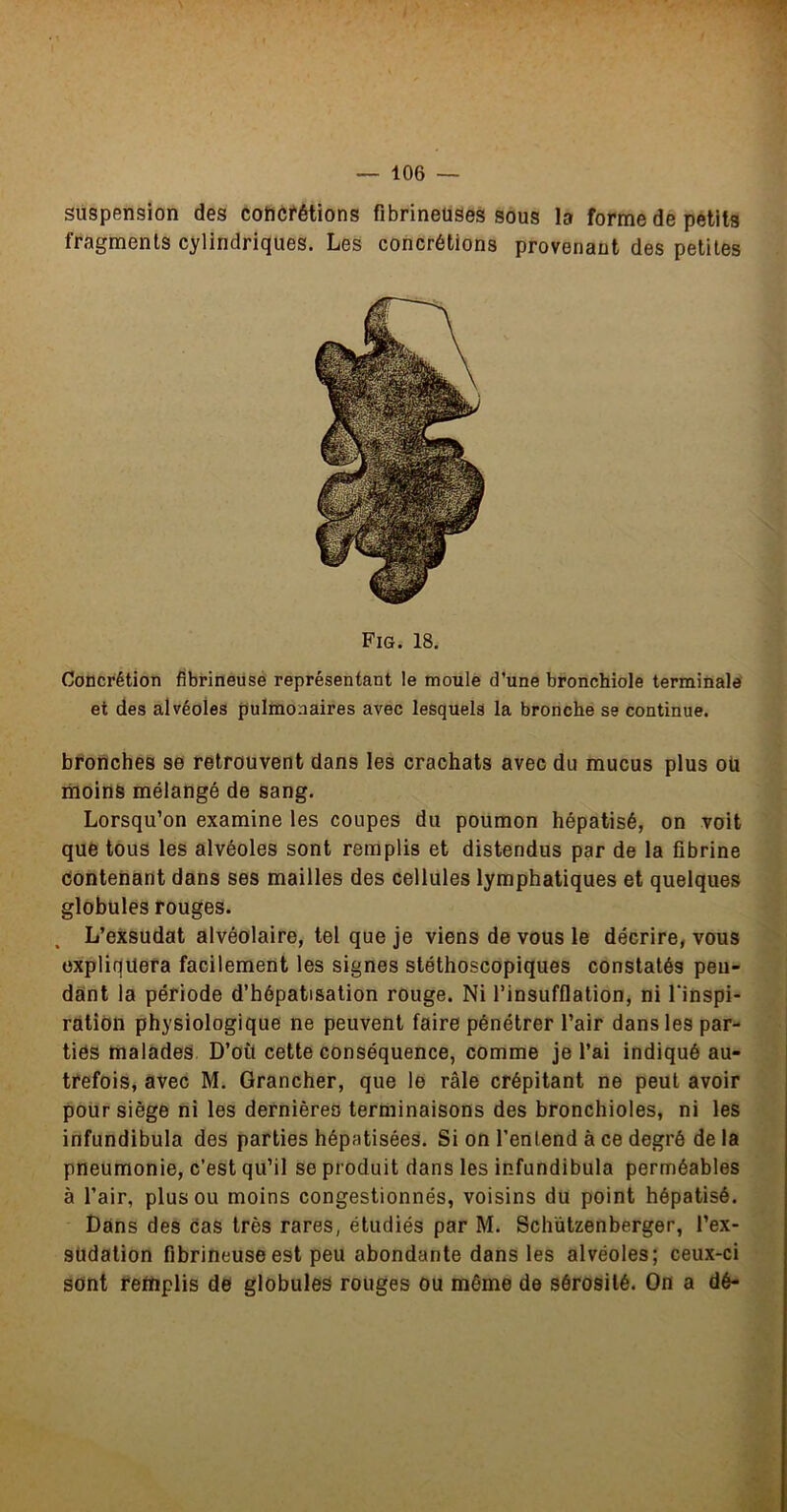suspension des cottcfétions fibrineuses sous la forme de petits fragments cylindriques. Les concrétions provenant des petites Fig. 18. Concrétion fibrineuse représentant le moule d’une bronchiole terrainalef et des alvéoles pulmonaires avec lesquels la bronche se continue. bronches se retrouvent dans les crachats avec du mucus plus oü moins mélangé de sang. Lorsqu’on examine les coupes du poumon hépatisé, on voit que tous les alvéoles sont remplis et distendus par de la fibrine Oontehant dans ses mailles des cellules lymphatiques et quelques globules rouges. L’exsudât alvéolaire, tel que je viens de vous le décrire, vous expliquera facilement les signes stéthoscopiques constatés pen- dant la période d’hépatisation rouge. Ni l’insufflation, ni l’inspi- ràtidn physiologique ne peuvent faire pénétrer l’air dans les par- ties malades. D’oü cette conséquence, comme je l’ai indiqué au- trefois, avec M. Grancher, que le râle crépitant ne peut avoir pour siège ni les dernières terminaisons des bronchioles, ni les infundibula des parties hépatisées. Si on l’entend à ce degré de la pneumonie, c’est qu’il se produit dans les infundibula perméables à l’air, plus ou moins congestionnés, voisins du point hépatisé. Dans des cas très rares, étudiés par M. Schützenberger, l’ex- südation fibrineuse est peu abondante dans les alvéoles; ceux-ci sont remplis dé globules rouges ou môme de sérosité. On a dé-