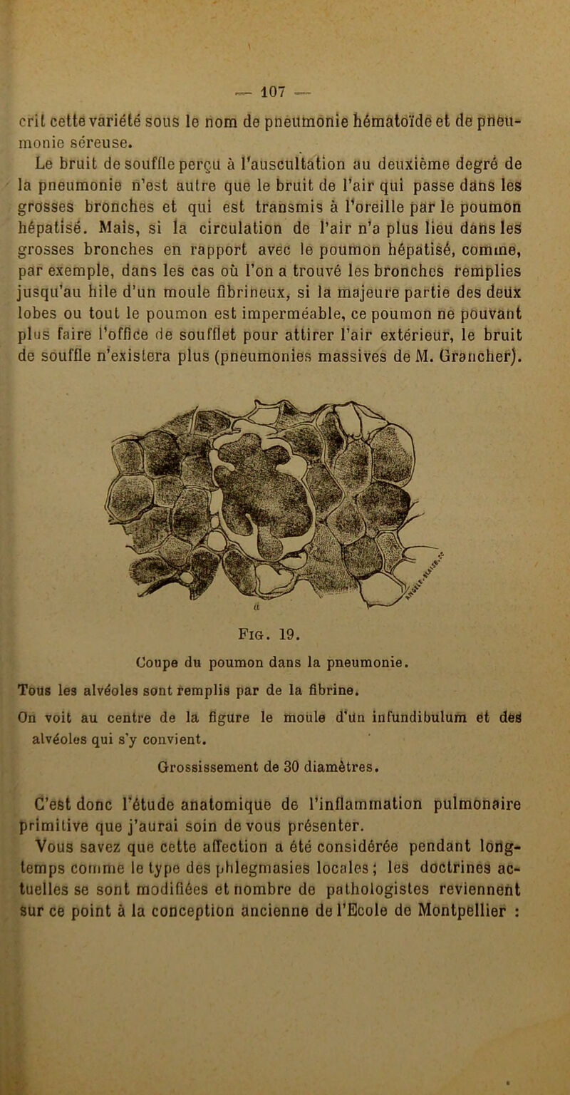 \ -- 107 — cri t cette variété SOUS le nom de pneumonie hématoïdë et de pneu- monie séreuse. Le bruit de souffle perçu à l’auscultation au deuxième degré de la pneumonie n’est autre que le bruit de l’air qui passe dans les grosses bronches et qui est transmis à l’oreille par le poumon hépatisé. Mais, si la circulation de l’air n’a plus lieu dans les grosses bronches en rapport avec le poumon hépatisé, comme, par exemple, dans les cas où l’on a trouvé les bronches remplies jusqu’au hile d’un moule fibrineux, si la majeure partie des deüx lobes ou tout le poumon est imperméable, ce poumon ne pouvant plus faire l’office de soufflet pour attirer l’air extérieur, le bruit de souffle n’existera plus (pneumonies massives de M. Grancher). Fig. 19. Coupe du poumon dans la pneumonie. Tous les alvéoles sont remplis par de la fibrine. On voit au centre de la figure le moüle d’ün infundibulum ët des alvéoles qui s’y convient. Grossissement de 30 diamètres. C’est donc l’étude anatomique de l’inflammation pulmonaire primitive que j’aurai soin devons présenter. Vous savez que cette affection a été considérée pendant long- temps comme le type des plilegmasies locales; les doctrines ac- tuelles se sont modifiées et nombre de pathologistes reviennent sur ce point à la conception ancienne de l’Ecole de Montpellier :