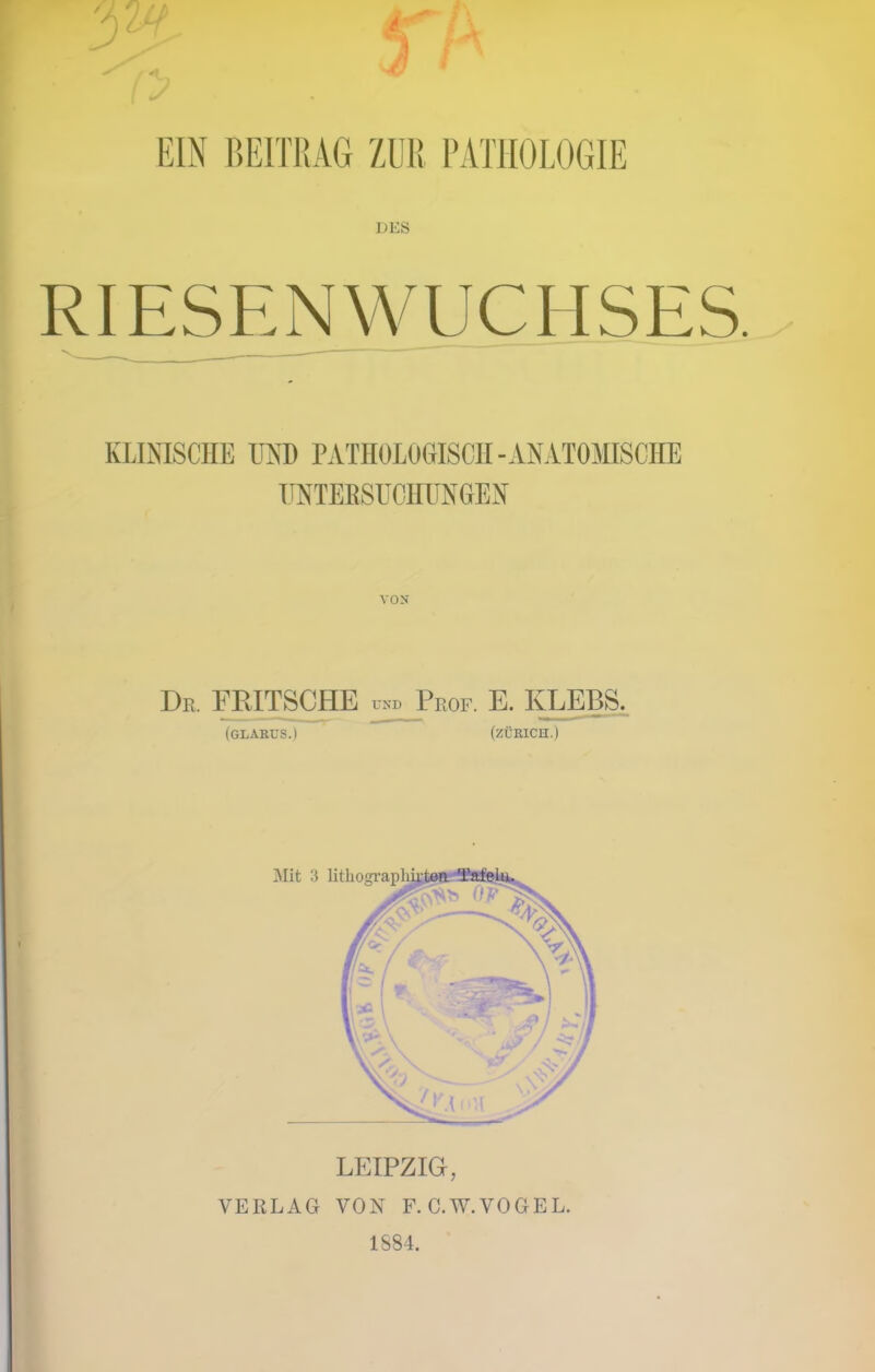 EIN BEITRAG ZUR, PATHOLOGIE DES RIESENWUCHSES. KLINISCHE UND PATHOLOGISCH-ANATOMISCHE UNTERSUCHUNGEN Df, PRITSCHE (glarus.) ctd Prof. E. KLEBS. (ZÜRICH.) LEIPZIG, VERLAG VON F.C.W.VOGEL. 1884.