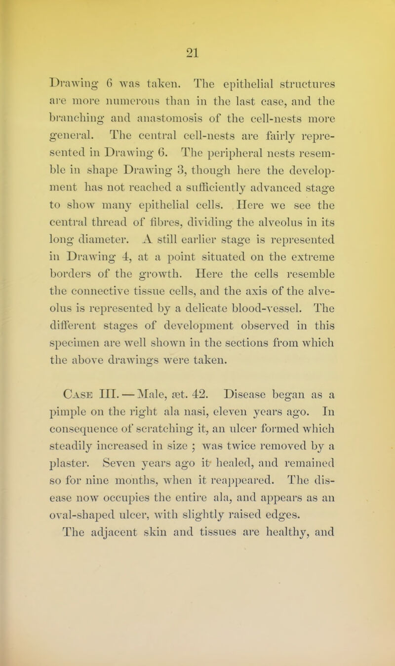 Drawing 6 was taken. The epithelial structures are more numerous than in the last case, and the branching and anastomosis of the cell-nests more general. The central cell-nests are fairly repre- sented in Drawing 6. The peripheral nests resem- ble in shape Drawing 3, though here the develop- ment has not reached a sufficiently advanced stage to show many epithelial cells. Here we see the central thread of fibres, dividing the alveolus in its long diameter. A still earlier stage is represented in D rawing 4, at a point situated on the extreme borders of the growth. Here the cells resemble the connective tissue cells, and the axis of the alve- olus is represented by a delicate blood-vessel. The different stages of development observed in this specimen are well shown in the sections from which the above drawings were taken. Case III. — Male, ret. 42. Disease began as a pimple on the right ala nasi, eleven years ago. In consequence of scratching it, an ulcer formed which steadily increased in size ; was twice removed by a plaster. Seven years ago it healed, and remained so for nine months, when it reappeared. The dis- ease now occupies the entire ala, and appears as an oval-shaped ulcer, with slightly raised edges. The adjacent skin and tissues are healthy, and