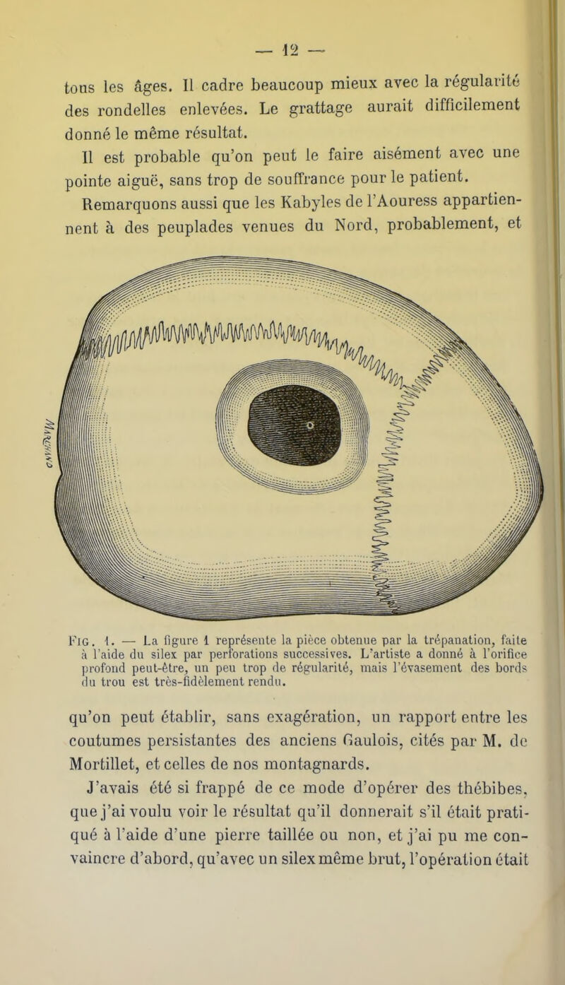 aNVHThlVfM tons les âges. Il cadre beaucoup mieux avec la régularité des rondelles enlevées. Le grattage aurait difficilement donné le même résultat. 11 est probable qu’on peut le faire aisément avec une pointe aiguë, sans trop de souffrance pour le patient. Remarquons aussi que les Kabyles de l’Aouress appartien- nent à des peuplades venues du Nord, probablement, et Fig. 1. — La figure 1 représente la pièce obtenue par la trépanation, faite à l’aide du silex par perforations successives. L'artiste a donné à l’orifice profond peut-être, un peu trop de régularité, mais l’évasement des bords du trou est très-fidèlement rendu. qu’on peut établir, sans exagération, un rapport entre les coutumes persistantes des anciens Gaulois, cités par M. de Mortillet, et celles de nos montagnards. J’avais été si frappé de ce mode d’opérer des thébibes, que j’ai voulu voir le résultat qu’il donnerait s’il était prati- qué à l'aide d’une pierre taillée ou non, et j’ai pu me con- vaincre d’abord, qu’avec un silex même brut, l’opération était