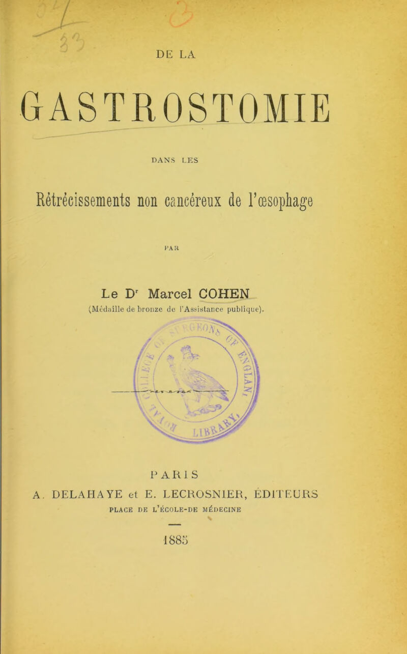 DE LA GASTROSTOMIE DANS LES Rétrécissements non cancéreux de l’œsophage PA II Le Dr Marcel COHEN (Médaille de bronze de l’Assistance publique). P A R 1 S A. DELAHAYE et E. LECROSN1ER, ÉDITEURS PLACE DE l’ÉCOLE-DE MÉDECINE 1885