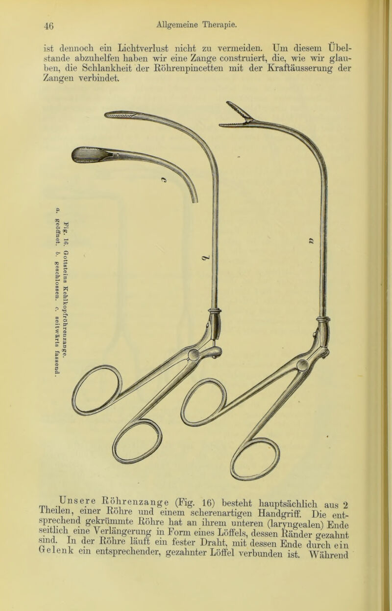 ist dennoch ein Liclitverlust nicht zu vermeiden. Um diesem Übel- stande abzuhelfen haben wir eine Zange construiert, die, wie wir glau- ben, die Schlankheit der Röhrenpincetten mit der Kraftäusserung der Zangen verbindet. O ‘Tj D c~ Q er 3 ö » s w ® © B et w ? •§ ® Cs ^ o S« c N ST 53 ® Ö B Unsere Röhrenzange (Fig. 16) besteht hauptsächlich aus 2 ineilen, einer Röhre und einem scherenartigen Handgriff. Die ent- sprechend gekrümmte Röhre hat an ihrem unteren (laryngealen) Ende seitlich eine Verlängerung in Form eines Löffels, dessen Ränder gezahnt sind. In der Röhre läuft eiu fester Draht, mit dessen Ende durch ein De lenk ein entsprechender, gezahnter Löffel verbunden ist. Während