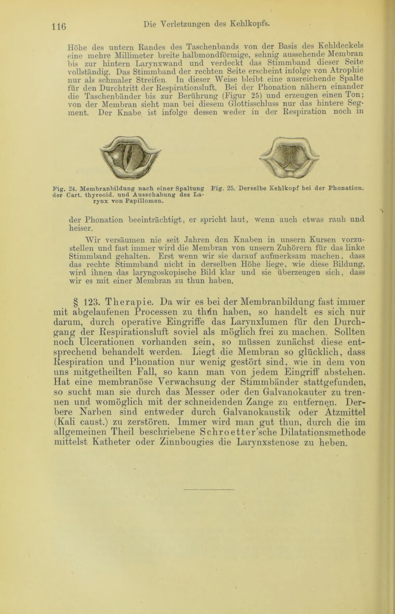 Höhe des untern Randes des Taschenbands von der Basis des Kehldeckels eine mehre Millimeter breite halbmondförmige, sehnig aussehende Membran bis zur hintern Larynxwand und verdeckt das Stimmband dieser Seite vollständig. Das Stimmband der rechten Seite erscheint infolge von Atrophie nur als schmaler Streifen. In dieser Weise bleibt eine ausreichende Spalte für den Durchtritt der Respirationsluft. Bei der Phonation nähern einander die Taschenbänder bis zur Berührung (Figur 25) und erzeugen einen Ton; von der Membran sieht man bei diesem Glottisschluss nur das hintere Seg- ment. Der Knabe ist infolge dessen weder in der Respiration noch in Fig. 24. Membranbildung nach einer Spaltung Fig. 25. Derselbe Kehlkopf bei der Phonation, der Cart. thyreoid. und Ausschabung des La- rynx von Papillomen. der Phonation beeinträchtigt, er spricht laut, wenn auch etwas rauh und heiser. Wir versäumen nie seit Jahren den Knaben in unsern Kursen vorzu- stellen und fast immer wird die Membran von unsern Zuhörern für das linke Stimmband gehalten. Erst wenn wir sie darauf aufmerksam machen, dass das rechte Stimmband nicht in derselben Höhe liege, wie diese Bildung, wird ihnen das laryngoskopische Bild klar und sie überzeugen sich, dass wir es mit einer Membran zu thun haben. § 123. Therapie. Da wir es bei der Membranbildung fast immer mit abgelaufenen Processen zu thrfn haben, so handelt es sich nur darum, durch operative Eingriffe das Larynxlumen für den Durch- gang der Respirationsluft soviel als möglich frei zu machen. Sollten noch Ulcerationen vorhanden sein, so müssen zunächst diese ent- sprechend behandelt werden. Liegt die Membran so glücklich, dass Respiration und Phonation nur wenig gestört sind, wie in dem von uns mitgetheilten Fall, so kann man von jedem Eingriff abstehen. Hat eine membranöse Verwachsung der Stimmbänder stattgefunden, so sucht man sie durch das Messer oder den Galvanokauter zu tren- nen und womöglich mit der schneidenden Zange zu entfernen. Der- bere Narben sind entweder durch Galvanokaustik oder Ätzmittel (Kali caust.) zu zerstören. Immer wird man gut thun, durch die im allgemeinen Theil beschriebene Schroetter’sche Dilatationsmethode mittelst Katheter oder Zinnbougies die Larynxstenose zu heben.