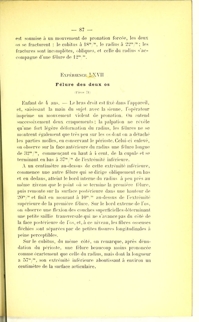 est soumise à un mouvement de pronation forcée, les deux os se fracturent : le cubitus à 18“ le radius à 2';?’;™; les IVacInres sont incomplètes, obliques, et celle du radius s’ac- compagne d’une f(Mure de 12“ Kxi’Ériexck LXVll Fêlure des deux os 1 '!>('(* 7 1 ) Enfant do 4 ans. — Le bras droit est lixé dans l’appareil, et, saisissaid la main du sujet av('C la sienne, l’oiiérateur imprinu' un mouvement violent de i>ronalion. On (uitend successivement deux craquements; la palpation ne révèle ((u’une fort légère déformation du radius, les fêlures ne se montrent également que ti ès ]ieu sur les os dont on a (bdaclié les parties molles, en conservaid b* périoste. Celui-ci enlevé, on observe sur la face anl('*ri('ure du radius une fêlure longiu' de 82“/“, commençant (ui haut à i- cent, de la cupub' et se terminant en bas à :t7' de l’extrémité inférieure. A un centimètre au-dessus de cette extrémité inlV‘ri(‘ui'e, commence une autre fêlure ([ui se dirige obliipiement en bas et en dedans, atteint le bord interne du radius à pmi près au même rdveau ([ue le point où se termine la première fêlun*, puis remonte sur la surface posli'u’ieure dans une bautmir de 20'/' (d bnit en mourant à 10' au-d('ssus de l'i-xtrêmiti' supérieure de la priunién^ fêlure. Sur le bord exteriu' di' l’os, on fibserve uiu' llexion des couebes superlicielles détmaninant une petit('saillie transversale (jiii no s’avance jias du côté de la face postérimm' de l’os, et, à ce niveau, les fibres osseuses llécbies sont séparées par de jietites tissimvs longitudinab's ù lieine perceptildes. Sur le cubitus, du même coté, on rmnarque, ai>rès (b'uiu- dation du périoste, une fêlure lu'aucoup moins prononcée comme écartement que celle du radius, mais dont la longueur a 57“/', son extrémité inférieure aboutissant à environ un centimètre de la surface articulaire.