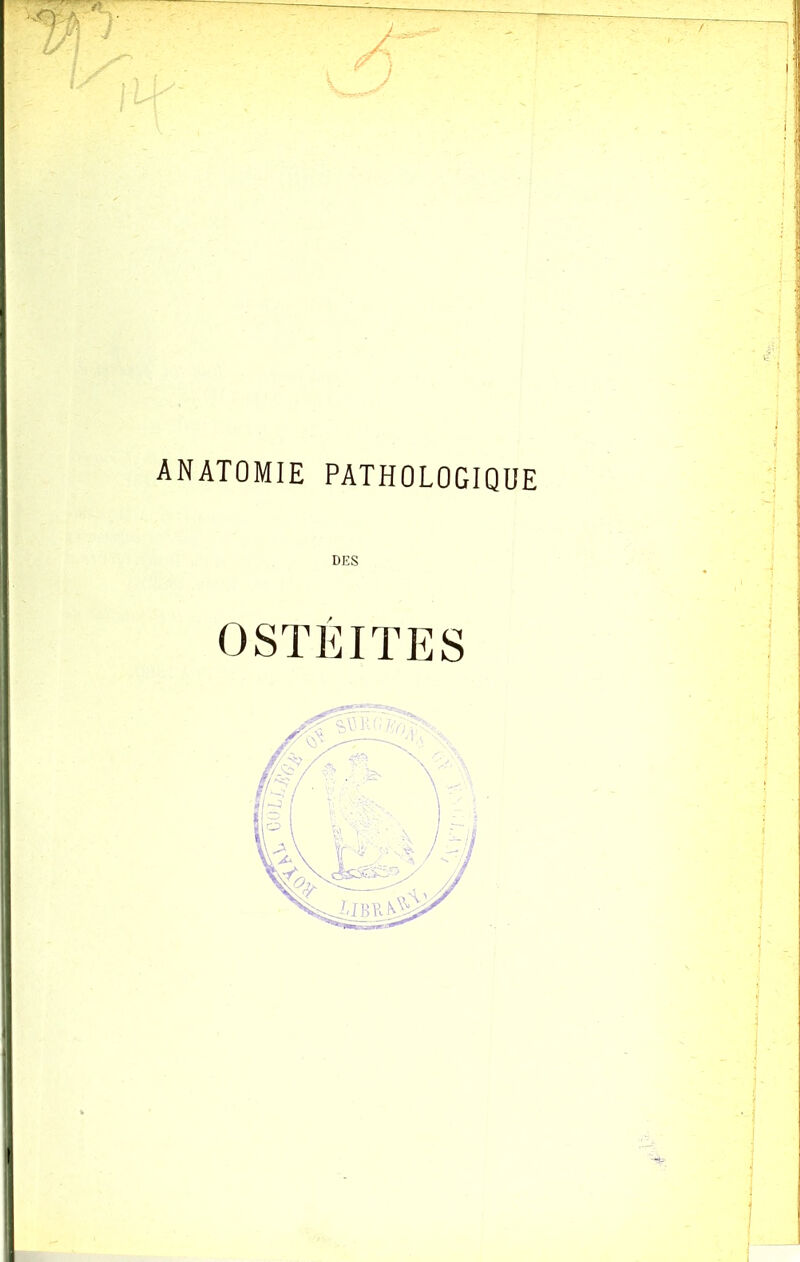ANATOMIE PATHOLOGIQUE OSTEITES