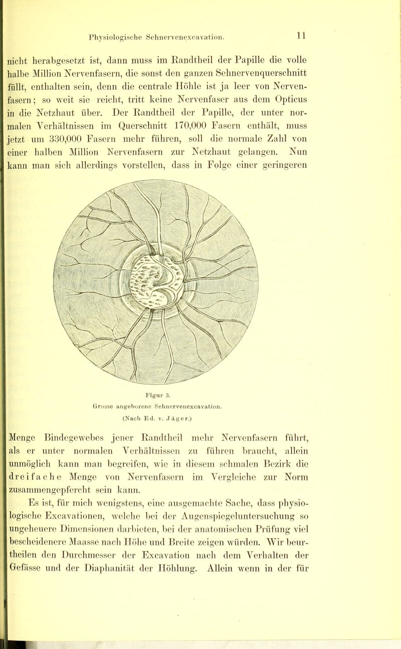 nicht herabgesetzt ist, dann muss im Randtheil der Papille die volle halbe Million Nervenfasern, die sonst den ganzen Sehnervenquerschnitt füllt, enthalten sein, denn die centrale Höhle ist ja leer von Nerven- fasern ; so weit sie reicht, tritt keine Nervenfaser aus dem Opticus in die Netzhaut über. Der Randtheil der Papille, der unter nor- malen Yerhältnissen im Querschnitt 170,000 Fasern enthält, muss jetzt um 330,000 Fasern mehr führen, soll die normale Zahl von einer halben Million Nervenfasern zur Netzhaut gelangen. Nun kann man sich allerdings vorstellen, dass in Folge einer geringeren (Nacli Etl. V. Jäger.) Menge Bindegewebes jener Randtheil mehr Nervenfasern führt, als er unter normalen Verhältnissen zu führen braucht, allein unmöglich kann man begreifen, wie in diesem schmalen Bezirk die dreifache Menge voii Nervenfasern im Vergleiche zur Norm zusammengepfercht sein kann. Es ist, für mich wenigstens, eine ausgemachte Sache, dass physio- logische Excavationen, welche bei der Augens])iegeluntersuchung so ungeheuere Dimensionen dai'bietcn, l)ei der anatomischen Prüfung viel bescheidenere Maasse nach Höhe und Breite zeigen würden. Wir beur- theilen den Durchmesser der Excavation nach dem Verhalten der Gefässe und der Diaphanität der Höhlung. Allein wenn in der für