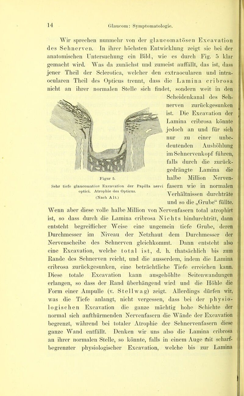 Wir sprechen nunmehr von der glancomatösen Excavation des Sehnerven. In ihrer höchsten Entwicklung zeigt sie bei der anatomischen Untersuchung ein Bild, wie es durch Fig. 5 klar gemacht wird. Was da zunächst und zumeist auffällt, das ist, dass jener Theil der Sclerotica, welcher den extraocularen und intra- ocularen Theil des Opticus trennt, dass die Lamina cribrosa nicht an ihrer normalen Stelle sich findet, sondern weit in den Scheidenkanal des Seh- nerven zurückgesunken ist. Die Excavation der Lamina cribrosa könnte jedoch an und für sich nur zu einer unbe- deutenden Aushöhlung im Sehnervenkopf führen, falls durch die zurück- gedrängte Lamina die Figur 5. halbe Million Nerven- Sehr tiefe glaucomatüse Excavation der Papilla nervi faSei’U wlo ill normalen optici. Atrophie des Opticus. xr n ..n • i i . .. i V erhaltmssen durchtrate (Xach Alt.) und so die „Grube“ füllte. Wenn aber diese volle halbe Million von Nervenfasern total atrophirt ist, so dass durch die Lamina cribrosa Nichts hindurchtritt, dann entsteht begreiflicher Weise eine ungemein tiefe Grube, deren Durchmesser im Niveau der Netzhaut dem Durchmesser der Nervenscheibe des Sehnerven gleichkommt. Dann entsteht also eine Excavation, welche total ist, d. h. thatsächlich bis zum Rande des Sehnerven reicht, und die ausserdem, indem die Lamina cribrosa zurückgesunken, eine beträchtliche Tiefe erreichen kann. Diese totale Excavation kann ansgehöhlte Seitenwandungen erlangen, so dass der Rand überhängend wird und die Höhle die Form einer Ampulle (v. Stell wag) zeigt. Allerdings dürfen w, was die Tiefe anlangt, nicht vergessen, dass bei der physio- logischen Excavation die ganze mächtig hohe Schichte der normal sich anfthürmenden Nervenfasern die Wände der Excavation begrenzt, während bei totaler Atrophie der Sehnervenfasern diese ganze Wand entfällt. Denken wir uns also die Lamina cribrosa an ihrer normalen Stelle, so könnte, falls in einem Auge rtiit scharf- begrenzter physiologischer Excavation, welche bis zur Lamina I