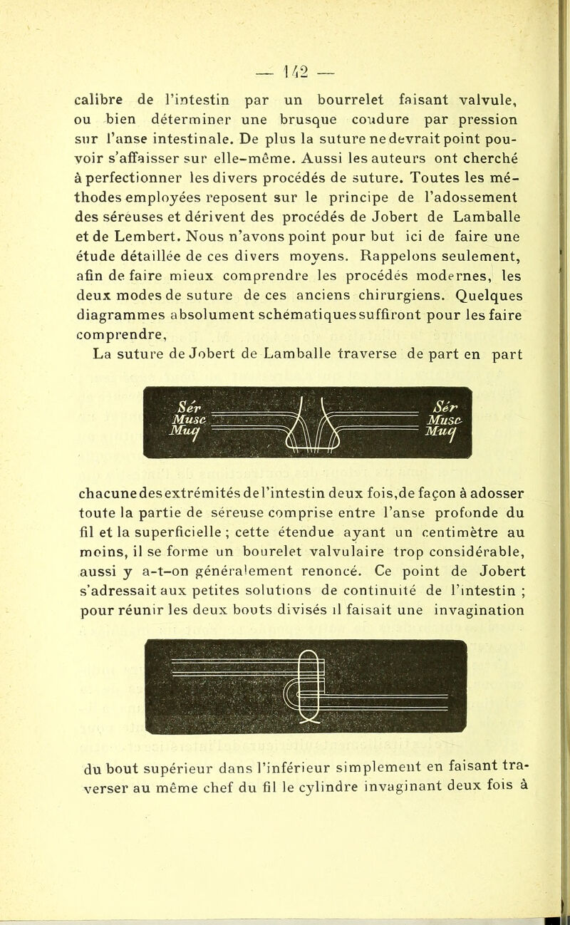 calibre de l’intestin par un bourrelet faisant valvule, ou bien déterminer une brusque coudure par pression sur l’anse intestinale. De plus la suture ne devrait point pou- voir s’affaisser sur elle-même. Aussi les auteurs ont cherché à perfectionner les divers procédés de suture. Toutes les mé- thodes employées reposent sur le principe de l’adossement des séreuses et dérivent des procédés de Jobert de Lamballe et de Lembert. Nous n’avons point pour but ici de faire une étude détaillée de ces divers moyens. Rappelons seulement, afin de faire mieux comprendre les procédés modernes, les deux modes de suture de ces anciens chirurgiens. Quelques diagrammes absolument schématiques suffiront pour les faire comprendre, La suture de Jobert de Lamballe traverse de part en part chacunedesextrémités del’intestin deux fois,de façon à adosser toute la partie de séreuse comprise entre l’anse profonde du fil et la superficielle ; cette étendue ayant un centimètre au moins, il se forme un bourelet valvulaire trop considérable, aussi y a-t-on généralement renoncé. Ce point de Jobert s’adressait aux petites solutions de continuité de l’intestin ; pour réunir les deux bouts divisés il faisait une invagination du bout supérieur dans l’inférieur simplement en faisant tra- verser au même chef du fil le cylindre invaginant deux fois à