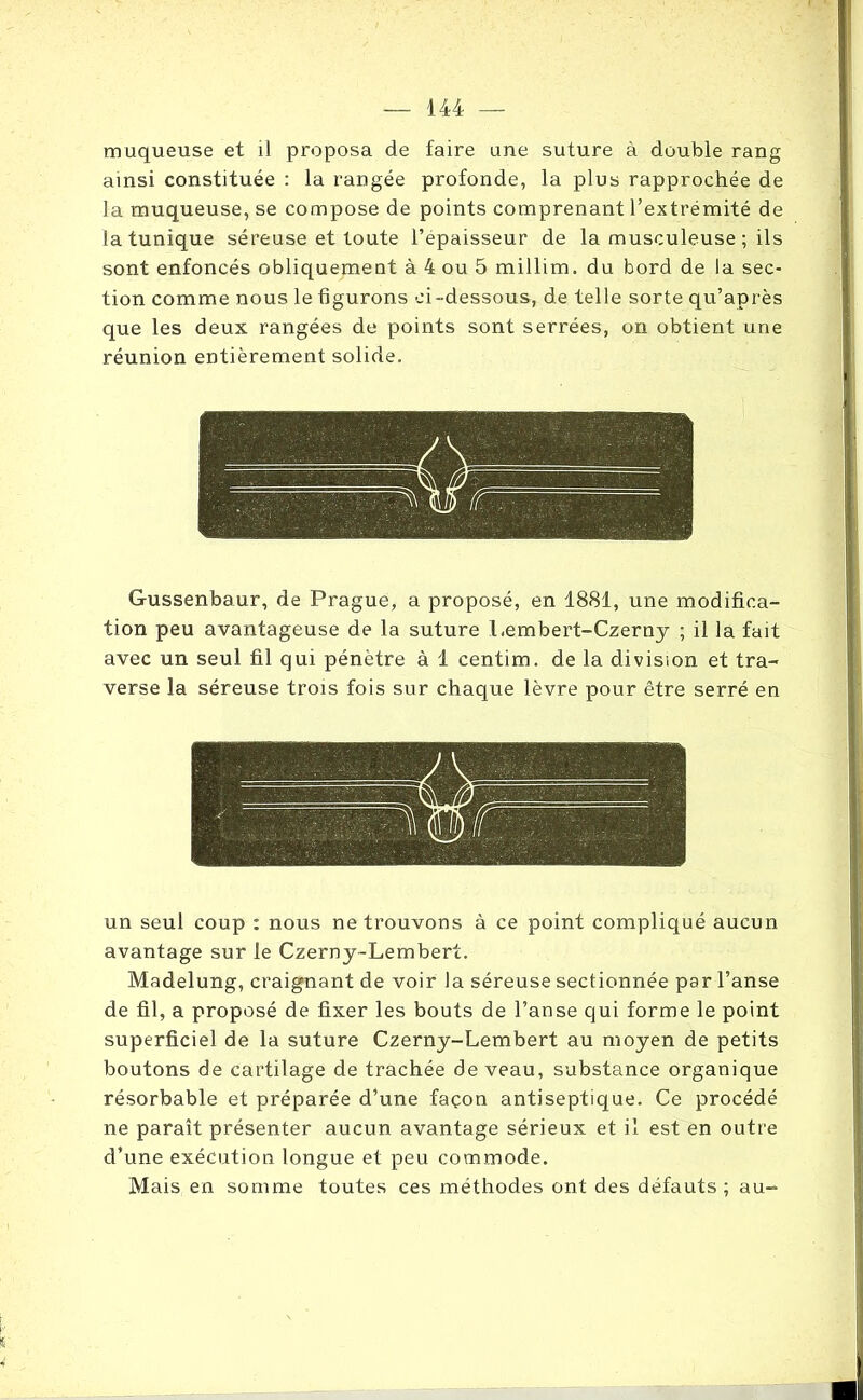 muqueuse et il proposa de faire une suture à double rang ainsi constituée : la rangée profonde, la plus rapprochée de la muqueuse, se compose de points comprenant l’extrémité de la tunique séreuse et toute l’épaisseur de la musculeuse ; ils sont enfoncés obliquement à 4 ou 5 millim. du bord de la sec- tion comme nous le figurons ci-dessous, de telle sorte qu’après que les deux rangées de points sont serrées, on obtient une réunion entièrement solide. Gussenbaur, de Prague, a proposé, en 1881, une modifica- tion peu avantageuse de la suture Lembert-Czerny ; il la fait avec un seul fil qui pénètre à 1 centim. de la division et tra- verse la séreuse trois fois sur chaque lèvre pour être serré en un seul coup : nous ne trouvons à ce point compliqué aucun avantage sur le Czerny-Lembert. Madelung, craignant de voir la séreuse sectionnée par l’anse de fil, a proposé de fixer les bouts de l’anse qui forme le point superficiel de la suture Czerny-Lembert au moyen de petits boutons de cartilage de trachée de veau, substance organique résorbable et préparée d’une façon antiseptique. Ce procédé ne paraît présenter aucun avantage sérieux et il est en outre d’une exécution longue et peu commode. Mais en somme toutes ces méthodes ont des défauts ; au-