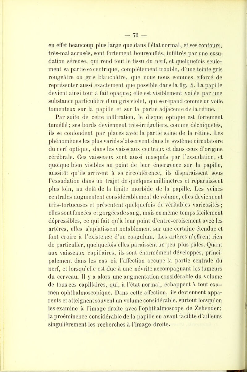 en effet beaucoup plus large que dans l’état normal, et ses contours, très-mal accusés, sont fortement boursouflés, infiltrés par une exsu- dation séreuse, qui rend tout le tissu du nerf, et quelquefois seule- ment sa partie excentrique, complètement trouble, d’une teinte gris rougeâtre ou gris blanchâtre, que nous nous sommes efforcé de représenter aussi exactement que possible dans la fig. 4. La papille devient ainsi tout à fait opaque; elle est visiblement voilée par une substance particulière d’un gris violet, qui se répand comme un voile tomenteux sur la papille et sur la partie adjacente de la rétine. Par suite de cette infiltration, le disque optique est fortement tuméfié; ses bords deviennent très-irréguliers, comme déchiquetés, ils se confondent par places avec la partie saine de la rétine. Les phénomènes les plus variés s’observent dans le système circulatoire du nerf optique, dans les vaisseaux centraux et dans ceux d’origine cérébrale. Ces vaisseaux sont aussi masqués par l’exsudation, et quoique bien visibles au point de leur émergence sur la papille, aussitôt qu’ils arrivent à sa circonférence, ils disparaissent sous l’exsudation dans un trajet de quelques millimètres et reparaissent plus loin, au delà de la limite morbide de la papille. Les veines centrales augmentent considérablement de volume, elles deviennent très-tortueuses et présentent quelquefois de véritables varicosités; elles sont foncées et gorgées de sang, mais en même temps facilement dépressibles, ce qui fait qu’à leur point d’entre-croisement avec les artères, elles s’aplatissent notablement sur une certaine étendue et font croire à l’existence d’un coagulum. Les artères n’offrent rien de particulier, quelquefois elles paraissent un peu plus pâles. Quant aux vaisseaux capillaires, ils sont énormément développés, princi- palement dans les cas où l’affection occupe la partie centrale du nerf, et lorsqu’elle est due à une névrite accompagnant les tumeurs du cerveau. Il y a alors une augmentation considérable du volume de tous ces capillaires, qui, à l’état normal, échappent à tout exa- men ophthalmoscopique. Dans cette affection, ils deviennent appa- rents et atteignentsouvent un volume considérable, surtout lorsqu’on les examine à l’image droite avec l’ophthalmoscope de Zehender; la proéminence considérable de la papille en avant facilite d’ailleurs singulièrement les recherches à l’image droite.
