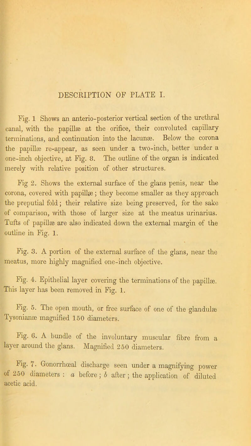 DESCRIPTION OF PLATE I. Fig. 1 Shows an anterio-posterior vertical section of the urethral canal, with the papillae at the orifice, their convoluted capillary terminations, and continuation into the lacunae. Below the corona the papillae re-appear, as seen under a two-inch, better under a one-inch objective, at Fig. 8. The outline of the organ is indicated merely with relative position of other structures. Fig 2. Shows the external surface of the glans penis, near the corona, covered with papillae ; they become smaller as they approach the preputial fold; their relative size being preserved, for the sake of comparison, with those of larger size at the meatus urinarius. Tufts of papillae are also indicated down the external margin of the outline in Fig. 1. Fig. 3. A portion of the external surface of the glans, near the meatus, more highly magnified one-inch objective. Fig. 4. Epithelial layer covering the terminations of the papillae. This layer has been removed in Fig. 1. Fig. 5. The open mouth, or free surface of one of the glandulse Tysonianae magnified 150 diameters. Fig. 6. A bundle of the involuntary muscular fibre from a layer around the glans. Magnified 250 diameters. Fig. 7. Gonorrhceal discharge seen under a magnifying power of 250 diameters : a before ; b after ; the application of diluted acetic acid.