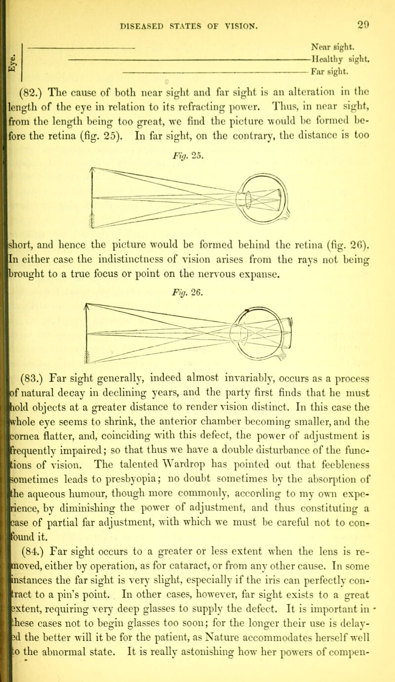 20 Near sight. -Healthy sight. Far sight. (82.) The cause of both near sight and far sight is an alteration in the length of the eye in relation to its refracting power. Thus, in near sight, from the length being too great, we find the picture would he formed be- fore the retina (fig. 25). In far sight, on the contrary, the distance is too short, and hence the picture wrould be formed behind the retina (fig. 26). |In either case the indistinctness of vision arises from the rays not being brought to a true focus or point on the nervous expanse. Fig. 26. / ——Y\ J (83.) Far sight generally, indeed almost invariably, occurs as a process >f natural decay in declining years, and the party first finds that he must lold objects at a greater distance to render vision distinct. In this case the vhole eye seems to shrink, the anterior chamber becoming smaller, and the ;oniea flatter, and, coinciding w ith this defect, the power of adjustment is requently impaired; so that thus wTe have a double disturbance of the func- -ions of vision. The talented Wardrop has pointed out that feebleness sometimes leads to presbyopia; no doubt sometimes by the absorption of he aqueous humour, though more commonly, according to my own expe- dience, by diminishing the powrer of adjustment, and thus constituting a ase of partial far adjustment, with which we must be careful not to con- bund it. (84.) Far sight occurs to a greater or less extent when the lens is re- eved, either by operation, as for cataract, or from any other cause. In some nstances the far sight is very slight, especially if the iris can perfectly con- ract to a pin’s point. In other cases, however, far sight exists to a great xtent, requiring very deep glasses to supply the defect. It is important in e cases not to begin glasses too soon; for the longer their use is delay- d the better will it be for the patient, as Nature accommodates herself well o the abnormal state. It is really astonishing how her powers of compen-