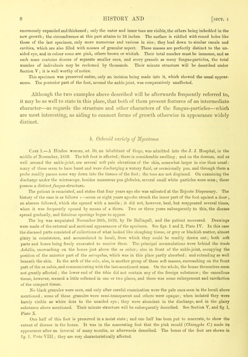 enormously expanded and thickened ; only the outer and inner toes are visible, the others being imbedded in the new growth ; the circumference at this part attains to 16 inches. The surface is riddled with round holes like those of the last specimen, only more numerous and various in size; they lead down to similar canals and cavities, which are also filled with masses of granular aspect. These masses are perfectly distinct to the un- aided eye, and in colour some are pink, others brown or whitish. Their total number must be immense, and as each mass contains dozens of separate smaller ones, and every granule as many fungus-particles, the total number of individuals may be reckoned by thousands. Their minute structure will be described under Section V ; it is well worthy of notice. This specimen was preserved entire, only an incision being made into it, which showed the usual appear- ances. The posterior part of the foot, around the ankle-joint, was comparatively unafi’ected. Although the two examples above described will be afterwards frequently referred to, it may be as well to state in this place, that both of them present features of an intermediate character—as regards the structure and other characters of the fungus-particles—which are most interesting, as aiding to connect forms of growth otherwise in appearance widely distinct. h. Ochroid variety of Mycetoma Case 1.—A Hindoo woman, mt. 50, an inhabitant of Gogo, was admitted into the J. J. Hospital, in the middle of November, 1859. The left foot is affected ; there is eonsiderable swelling; and on the dorsum, and as well around the ankle-joint, are several soft pale elevations of the skin, somewhat larger in size than usual: many of these seem to have burst and were discharging a watery fluid, or occasionally pus, and through them a probe readily passes some way down into the tissues of the foot; the toes are not displaced. On examining the discharge under the microscope, besides numerous pus globules, several small white particles were seen; these possess a distinct/i«*y“s-8tructure. The patient is emaciated, and states that four years ago she was salivated at the Eajcote Dispensary. The history of the case is as follows :—seven or eight years ago she struck the inner part of the foot against a door ; an abscess followed, which she opened with a needle; it did not, however, heal, but reappeared several times, when it was frequently opened by means of a thorn. Two or three years subsequently to this, the disease spread gradually, and fistulous openings began to appear. The leg was amputated November 30th, 1859, by Dr Ballingall, and the patient recovered. Drawings were made of the external and sectional appearances of the specimen. See figs. 1 and 2, Plate IV. In this case the diseased parts consisted of collections of what looked like sloughing tissue, or grey or blackish matter, almost glairy in consistence, and accumulated in loculi, from which they could be readily drawn out; both soft parts and bones being freely excavated to receive them. The principal accumulations were behind the tendo Achillis, encroaching on the bones just above the os calcis; also in front of the ankle-joint, occupying the position of the anterior part of the astragalus, which was in this place partly absorbed ; and extending as well beneath the skin. In the arch of the sole, also, is another group of these soft masses, encroaching on the front part of the os calcis, and communicating with the last-mentioned mass. On the whole, the bones themselves seem not greatly afi’ected ; the lower end of the tibia did not contain any of the foreign substance ; the cancellous tissue, however, seemed a little softened in one or two places, and there was some enlargement and rarefaction of the compact tissue. No black granules were seen, and only after careful examination were the pale ones seen in the loculi above mentioned ; some of these granules were semi-transparent and others were opaque; when isolated they were barely visible as white dots to the unaided eye; they were abundant in the discharge, and in the glairy substance above mentioned. Their minute structure will be subsequently described. See Section V, and fig. 1, Plate X. One half of this foot is preserved in a moist state; and one half has been put to macerate, to show the extent of disease in the bones. It was in the macerating foot that the pink mould (Chiongphe C.) made its appearance after an interval of many months, as afterwards described. The bones of the foot are shown in fig. 1, Plate VIII; they are very characteristically affected.