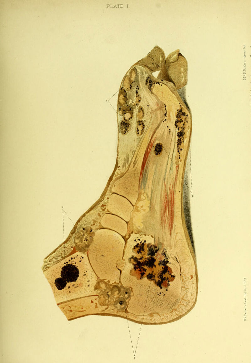 1 PLATE I Hy.Carier adna.t,ieL Oct. 1859. . MtN.Ha.ntart cbromo litL