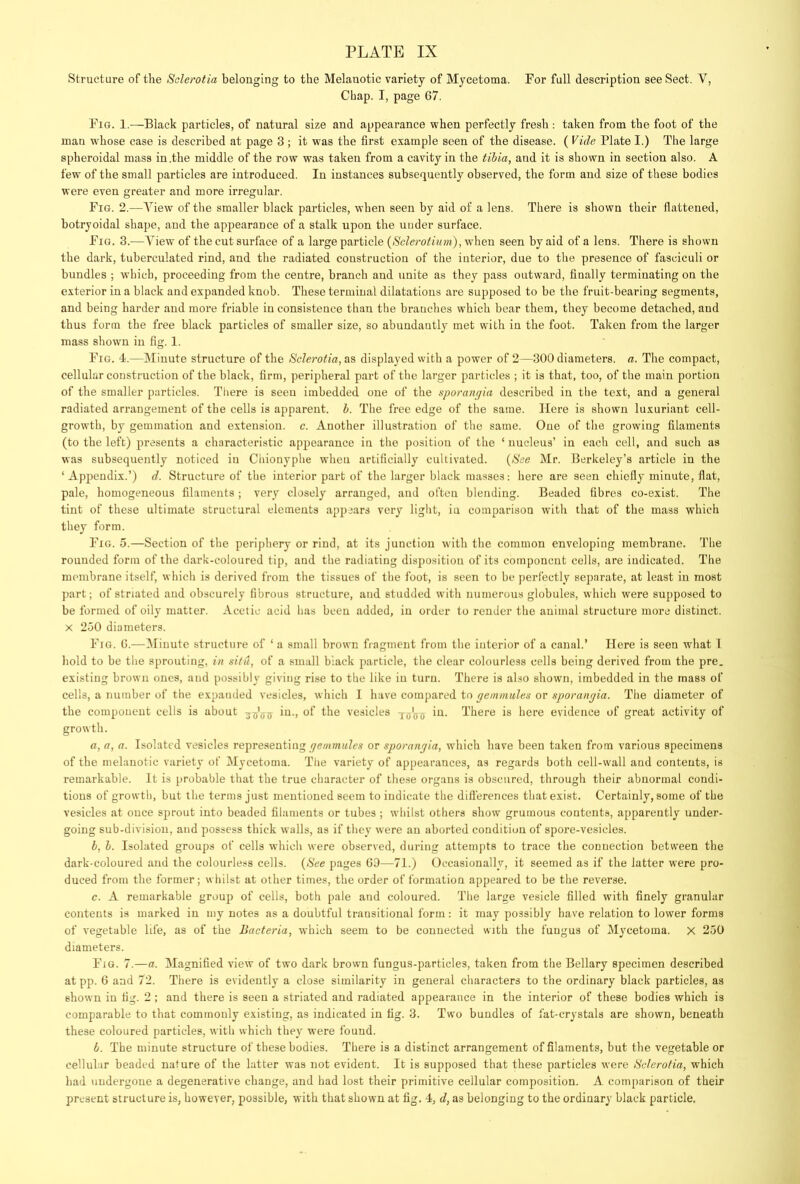Structure of the Sclerotia belonging to the Melanotic variety of Mycetoma. For full description see Sect. V, Chap. I, page 67. Fig. 1.—Black particles, of natural size and appearance vyhen perfectly fresh : taken from the foot of the man whose case is described at page 3 ; it was the first example seen of the disease. ( Vide Plate I.) The large spheroidal mass in .the middle of the row was taken from a cavity in the tibia, and it is shown in section also. A few of the small particles are introduced. In instances subsequently observed, the form and size of these bodies were even greater and more irregular. Fig. 2.—View of the smaller black particles, when seen by aid of a lens. There is shown their flattened, botryoidal shape, and the appearance of a stalk upon the under surface. Fig. 3.—View of the cut surface of a large particle {Sclerotium), wdieu seen by aid of a lens. There is shown the dark, tuberculated rind, and the radiated construction of the interior, due to the presence of fasciculi or bundles ; which, proceeding from the centre, branch and unite as they pass outward, finally terminating on the exterior in a black and expanded knob. These terminal dilatations are supposed to be the fruit-bearing segments, and being harder and more friable in consistence than the branches which bear them, they become detached, and thus form the free black particles of smaller size, so abundantly met with in the foot. Taken from the larger mass showm in fig. 1. Fig. 4.—Minute structure of the Sclerotia, as displayed with a power of 2—300 diameters, a. The compact, cellular construction of the black, firm, peripheral part of the larger particles ; it is that, too, of the main portion of the smaller particles. There is seen imbedded one of the sporangia described in the text, and a general radiated arrangement of the cells is apparent, h. The free edge of the same. Here is shown luxuriant cell- growth, by gemmation and extension, c. Another illustration of the same. One of the growing filaments (to the left) presents a characteristic appearance in the position of the ‘ nucleus’ in each cell, and such as was subsequently noticed in Chionyphe when artificially cultivated. {See Mr. Berkeley’s article in the ‘Appendix.’) d. Structure of the interior part of the larger black masses; here are seen chiefly minute, flat, pale, homogeneous filaments; very closely arranged, and often blending. Beaded fibres co-exist. The tint of these ultimate structural elements appears very light, in comparison with that of the mass which they form. Fig. 5.—Section of the periphery or rind, at its junction with the common enveloping membrane. The rounded form of the dark-coloured tip, and the radiating disposition of its component cells, are indicated. The membrane itself, which is derived from the tissues of the foot, is seen to be perfectly separate, at least in most part; of striated and obscurely fibrous structure, aud studded with numerous globules, which were supposed to be formed of oily matter. Acetic acid has been added, in order to render the animal structure more distinct. X 250 diameters. Fig. 6.—-Minute structure of ‘a small brown fragment from the interior of a canal.’ Here is seen what 1 hold to be the sprouting, in situ, of a small black particle, the clear colourless cells being derived from the pre. existing brown ones, and possibly giving rise to the like in turn. There is also shown, imbedded in the mass of cells, a number of the expanded vesicles, which 1 have compared to gemmales or sporangia. The diameter of the component cells is about iu., of the vesicles -j-oW There is here evidence of great activity of growth. a, a, a. Isolated vesicles representing or sporangia, which have been taken from various specimens of the melanotic variety of Mycetoma. The variety of appearances, as regards both cell-wall and contents, is remarkable. It is probable that the true character of these organs is obscured, through their abnormal condi- tions of growth, but the terms just mentioned seem to indicate the dift'erences that exist. Certainly, some of the vesicles at once sjirout into beaded filaments or tubes ; whilst others show grumous contents, apparently under- going sub-division, and possess thick walls, as if they were an aborted condition of spore-vesicles. b, b. Isolated groups of cells which were observed, during attempts to trace the connection between the dark-coloured aud the colourless cells. {See pages 63—71.) Occasionally, it seemed as if the latter w’ere pro- duced from the former; whilst at other times, the order of formation appeared to be the reverse. c, A remarkable group of cells, both pale and coloured. The large vesicle filled with finely granular contents is marked in my notes as a doubtful transitional form: it may possibly have relation to lower forms of vegetable life, as of the Bacteria, which seem to be connected with the fungus of Mycetoma. X 250 diameters. Fig. 7.—a. Magnified view of two dark brown fungus-particles, taken from the Bellary specimen described at pp. 6 and 72. There is evidently a close similarity in general characters to the ordinary black particles, as shown iu fig. 2 ; and there is seen a striated and radiated appearance in the interior of these bodies which is comparable to that commonly existing, as indicated in fig. 3. Two bundles of fat-crystals are shown, beneath these coloured particles, with which they were found. b. The minute structure of these bodies. There is a distinct arrangement of filaments, but the vegetable or cellular beaded nature of the latter was not evident. It is supposed that these particles were Sclerotia, which had undergone a degenerative change, and had lost their primitive cellular composition. A comparison of their present structure is, however, possible, with that shown at fig. 4, d, as belonging to the ordinary black particle.