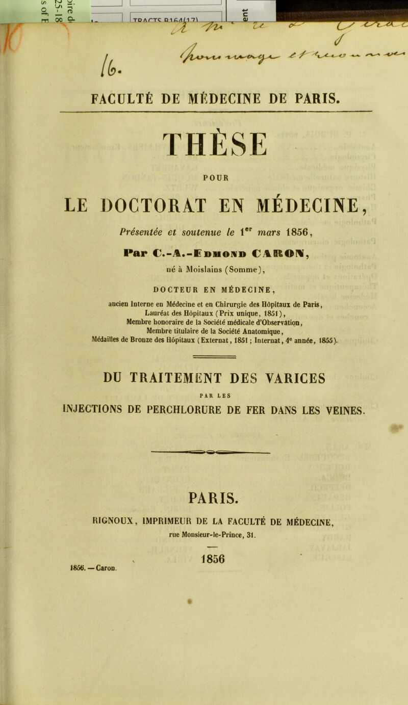 FACULTÉ DE MÉDECINE DE PARIS. POUR LE DOCTORAT EN MÉDECINE, Présentée et soutenue le 1®** mars 1856, Par C.-JL.-Ebiiomd né à Moislains (Somme), DOCTEUR EN MÉDECINE, ancien Interne en Médecine et en Chirurgie des Hôpitaux de Paris, Lauréat des Hôpitaux (Prix unique, 1851), Membre honoraire de la Société médicale d’Observation, Membre titulaire de la Société Anatomique, Médailles de Bronze des Hôpitaux (Externat, 1851 ; Internat, 4® année, 1855). DU TRAITEMENT DES VARICES PAR LES INJECTIONS DE PERCHLORÜRE DE FER DANS LES VEINES. PARIS. lUGNOUX, IMPRIMEUR DE LA FACULTÉ DE MÉDECINE, rue Monsieur-le-Prince, 31. 1856